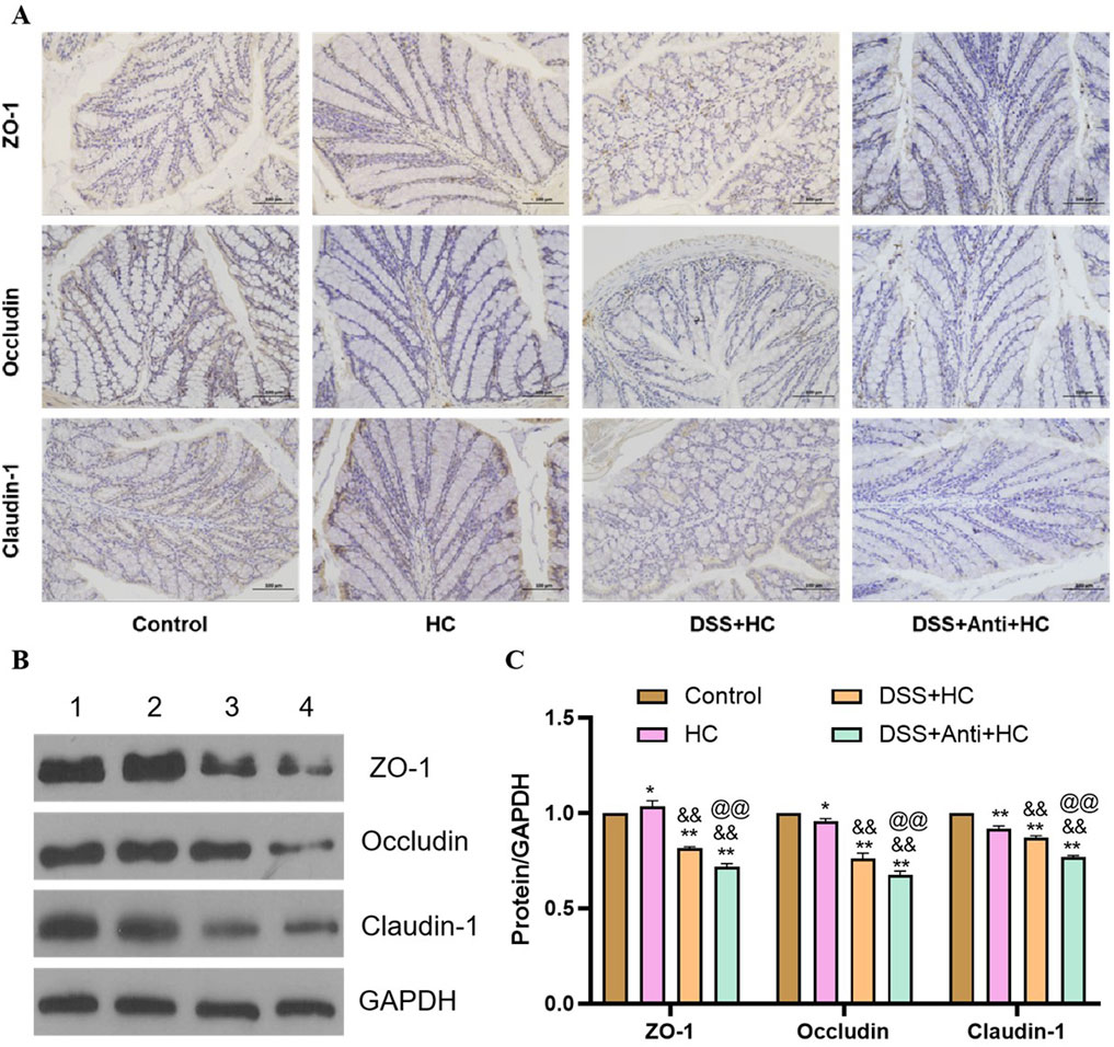 Panel A shows immunohistochemical staining of ZO-1, Occludin, and Claudin-1 in intestinal tissues under different conditions: Control, HC, DSS+HC, and DSS+Anti+HC. Panel B displays Western blot images for these proteins and GAPDH across four conditions. Panel C presents a bar graph comparing the protein levels relative to GAPDH, with different color-coded conditions including Control, HC, DSS+HC, and DSS+Anti+HC, indicating significant differences between groups.