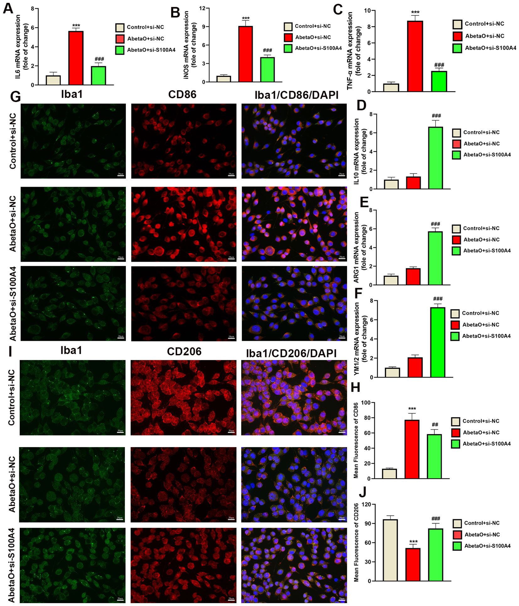 Bar graphs (A-F) display the expression levels of IL6, NOS2, TNF, IL10, ARG1, and YM1/2 mRNA, indicating significant differences between control and experimental groups. Fluorescent microscopy images (G-I) show Iba1, CD86, and CD206 staining in green, red, and blue. Images compare control and treated groups with scale bars for reference. Bar graphs (H-J) quantify mean fluorescence of CD86 and CD206, indicating significant changes across groups. The data suggests modulation of gene expression and protein levels.