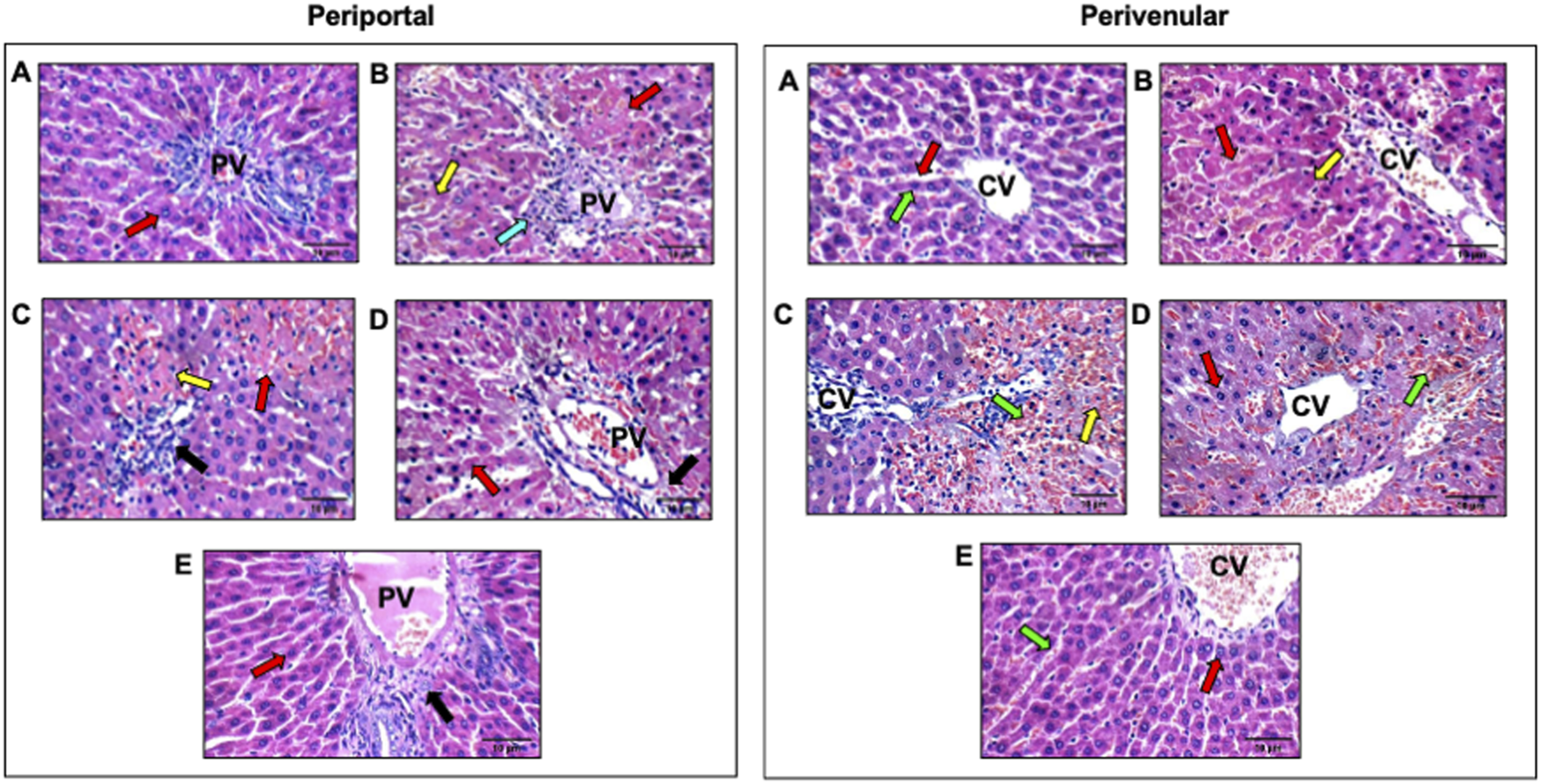 Histological comparison of liver sections showing periportal and perivenular regions stained with hematoxylin and eosin. On the left, periportal sections are labeled A to E, highlighting portal vein (PV) areas with arrows in various colors indicating specific features. On the right, perivenular sections labeled A to E, center around central vein (CV) areas, with similar color-coded arrows marking distinct structures. Each section provides a detailed view of liver tissue morphology across these regions.