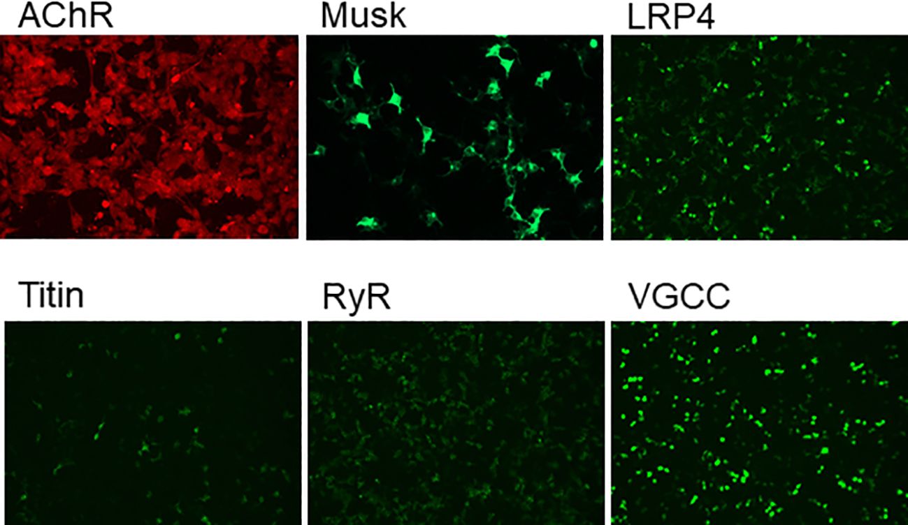 Six fluorescence microscopy images display different protein expressions: AChR in red, Musk, LRP4, Titin, RyR, and VGCC in green. Each image shows distinct patterns of fluorescence, indicating varying levels of protein presence.