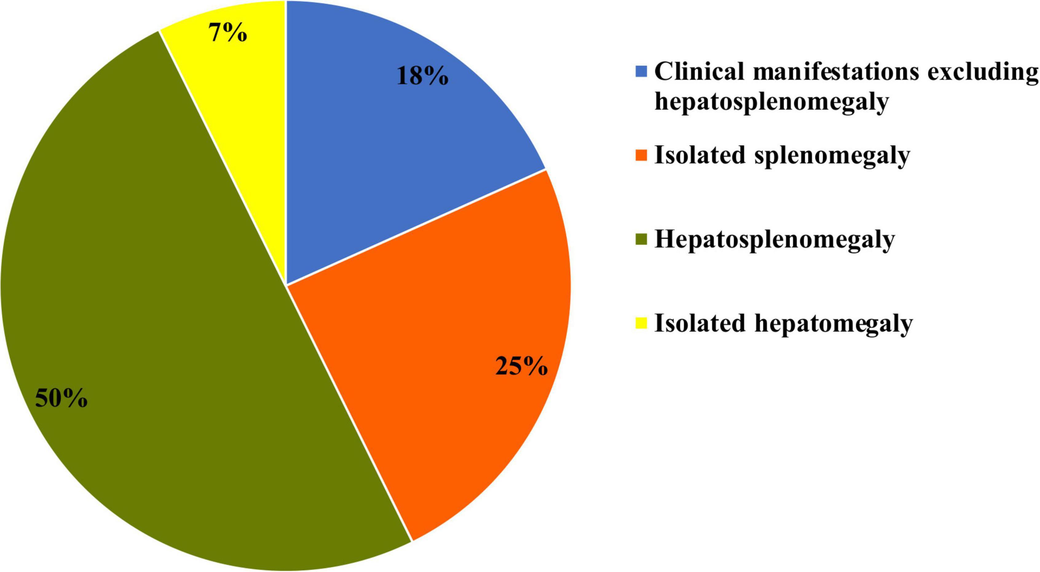 Pie chart showing clinical manifestations related to hepatosplenomegaly. Fifty percent display hepatosplenomegaly, 25% isolated splenomegaly, 18% clinical manifestations excluding hepatosplenomegaly, and 7% isolated hepatomegaly.
