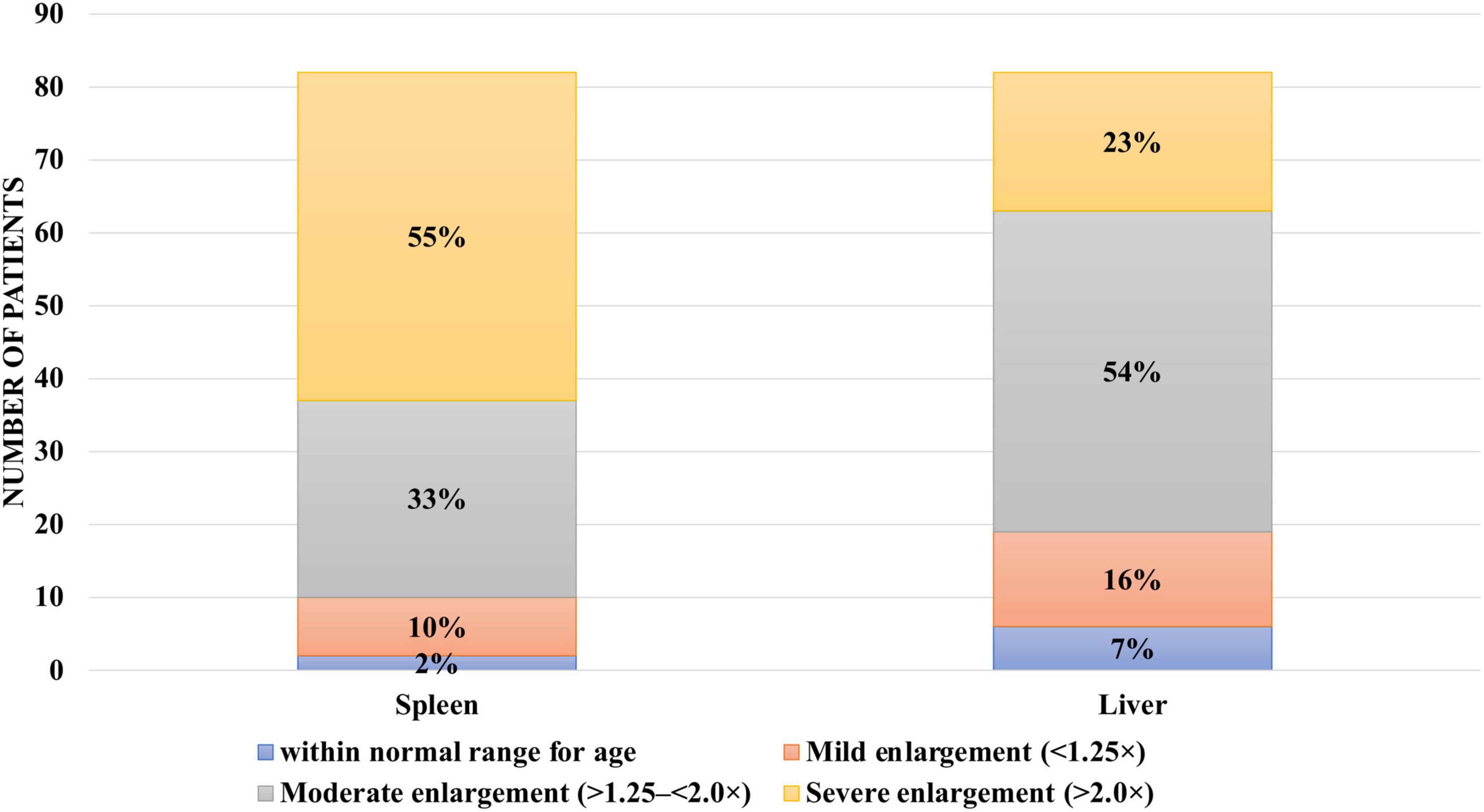 Bar chart showing the number of patients with spleen and liver enlargement. For the spleen, 2% within normal range, 10% mild enlargement, 33% moderate enlargement, and 55% severe enlargement. For the liver, 7% within normal range, 16% mild enlargement, 54% moderate enlargement, and 23% severe enlargement.