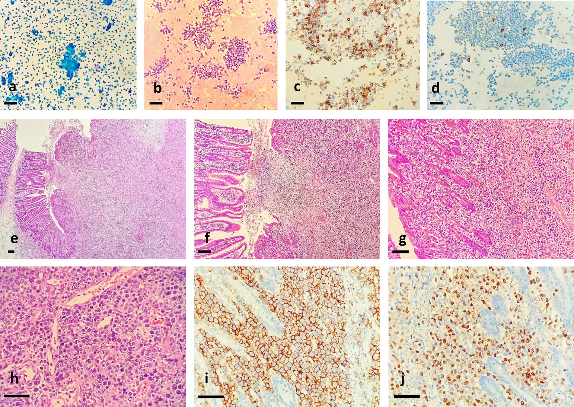 Microscopic images showcasing cell mass and histological samples labeled from a to j. Each image displays different tissue structures and staining techniques, highlighting cellular details. The variations in color and texture indicate diverse histological features and potential pathological conditions, with scale bars for reference.