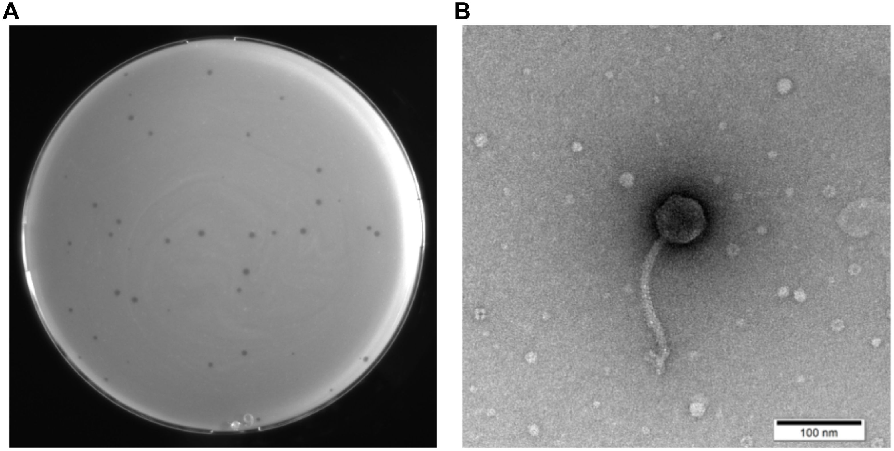 Panel A shows a petri dish with small dark spots indicating bacterial colonies. Panel B presents a close-up electron microscope image of a bacteriophage with a distinct head and tail structure, adjacent to a scale bar of one hundred nanometers.