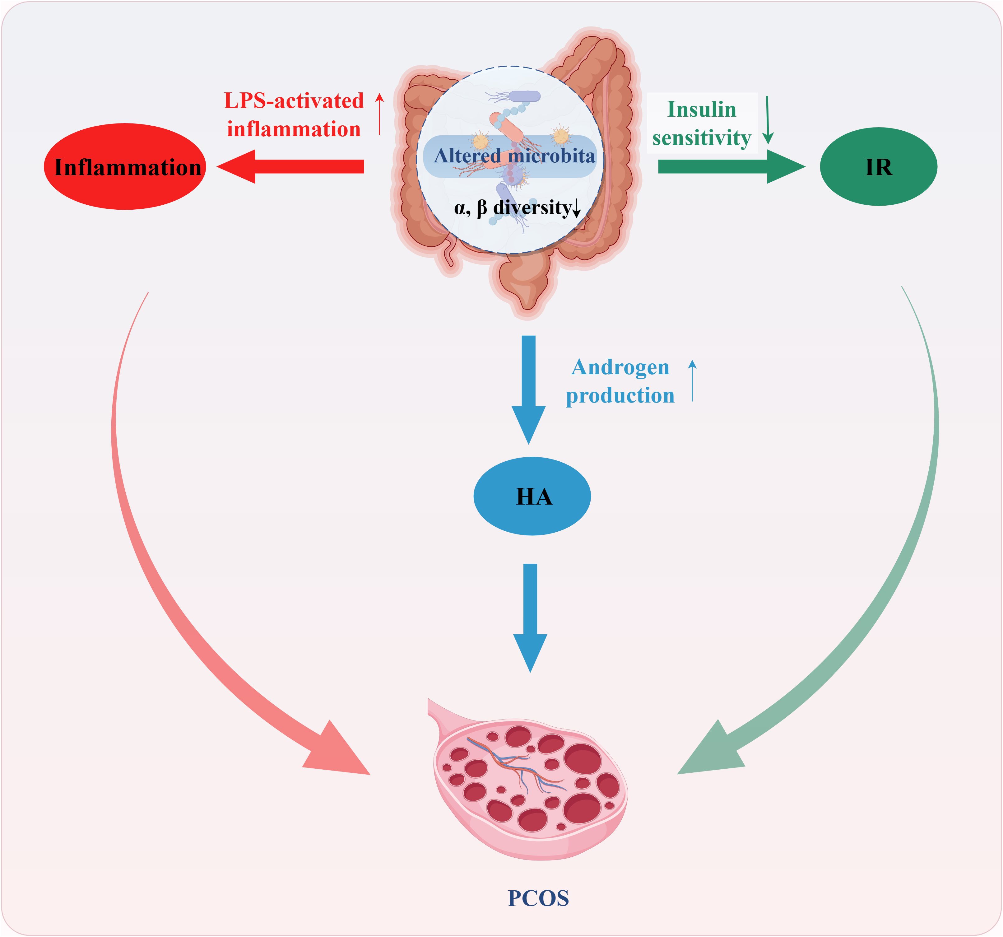 Diagram illustrating the relationship between altered gut microbiota, inflammation, and insulin resistance (IR) influencing polycystic ovary syndrome (PCOS). It shows decreased microbial diversity leading to increased LPS-triggered inflammation and decreased insulin sensitivity. These factors contribute to hyperandrogenism (HA), which is linked to PCOS development.