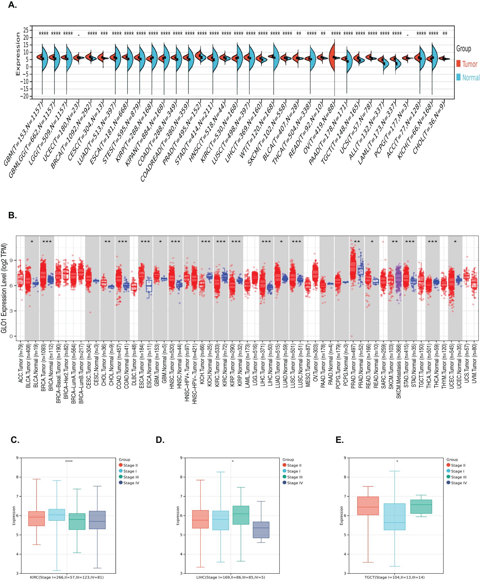 A series of charts displaying expression data across various cancer types and stages. A. Violin plots show expression levels for tumor and normal groups across different cancer types. B. Box plots illustrate Q6LO1 expression levels in several tumor and normal samples. C-E. Box plots depict expression levels at different cancer stages: kidney renal clear cell carcinoma (KIRC), lung squamous cell carcinoma (LUSC), and testicular germ cell tumors (TGCT), with staging groups colored differently.