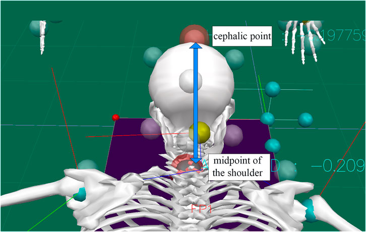 A 3D graphical representation of an anatomical model showing the cephalic point and midpoint of the shoulder. An arrow indicates the vertical alignment between these points on a skeletal structure. The background features a grid and additional skeletal views.