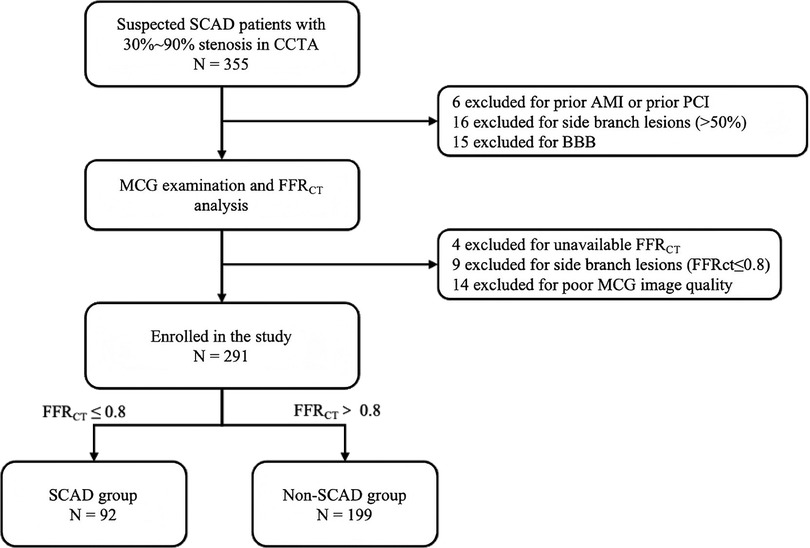Flowchart depicting a study selection process for suspected SCAD patients with thirty to ninety percent stenosis in CCTA. Initially, 355 patients are identified. After exclusions—six for prior AMI or PCI, sixteen for side branch lesions, and fifteen for BBB—291 are enrolled. Further exclusions occur for unavailable FFRCT, side branch lesions, and poor MCG image quality. The remaining patients are divided into SCAD (n=92) and Non-SCAD (n=199) groups based on FFRCT values.