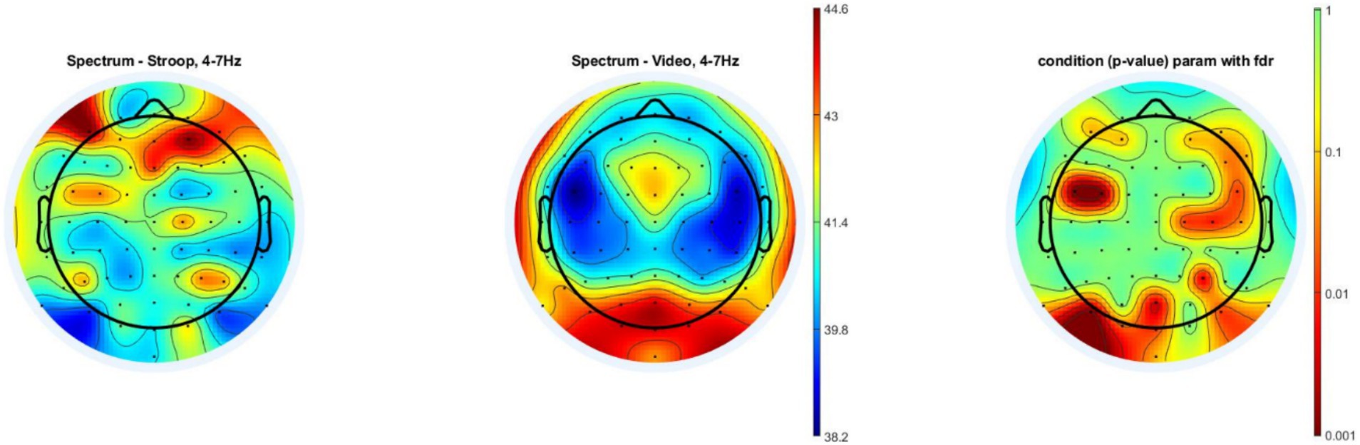Three brain activity heat maps are shown, each representing different conditions. The first map shows the Stroop spectrum at four to seven hertz. The second map shows the video spectrum at four to seven hertz. The third map depicts a condition with p-values, using a false discovery rate. Each map uses a color gradient from blue to red, indicating varying levels of activity.