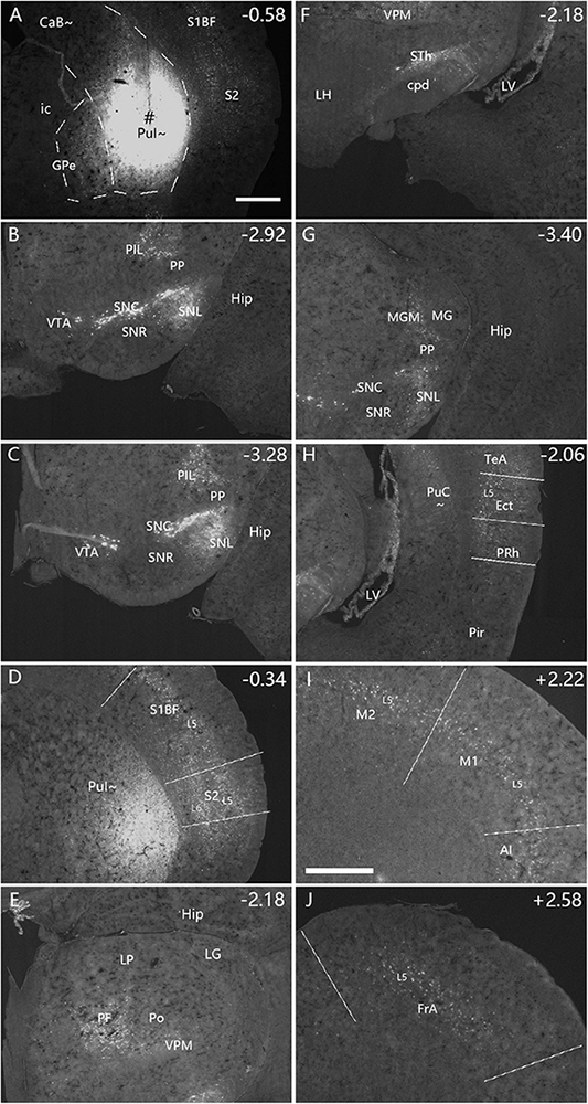 A series of brain slice images labeled from A to J, each showing different regions with marked structures such as Pul, S1BF, Hip, VTA, SNL, and others. The images depict various sections with corresponding numerical coordinates indicating their position. Different areas and labels like CaB, GPe, LH, and LG are highlighted, providing a detailed overview of anatomical landmarks.