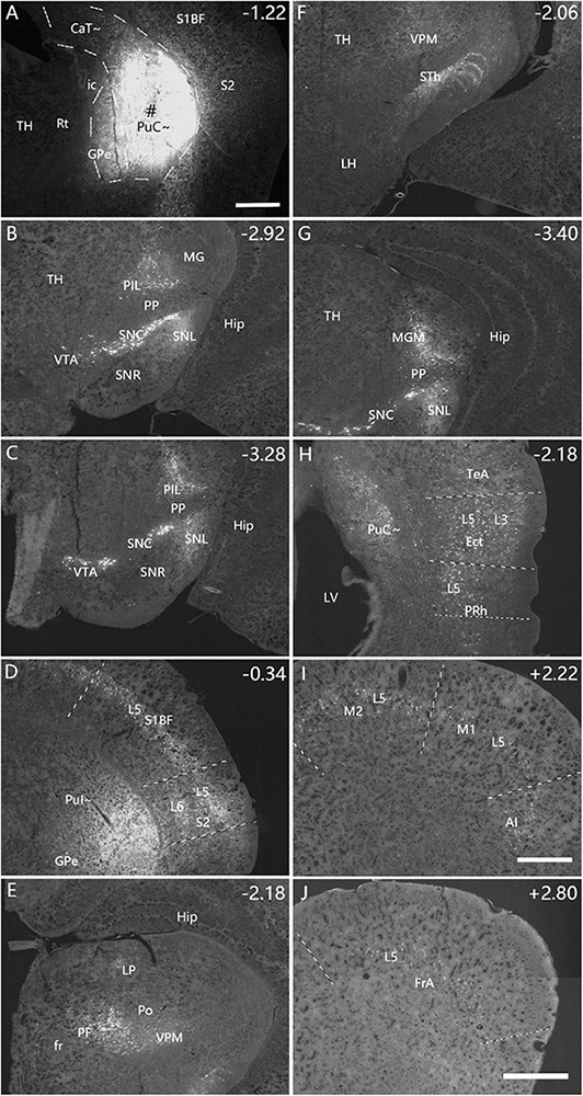 Collage of ten labeled brain section images, each marked with various anatomical regions and numerical indicators. Panels A-J display different sections with labels like TH, PuC, S1BF, VPM, SNC, and Hip, indicating brain areas. Each image has specific coordinates, showing different sectional views and highlighting neural structures for scientific examination.