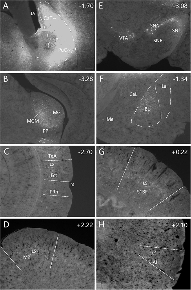 Composite image showing eight panels of brain tissue sections labeled with various anatomical regions and coordinates. Each panel identifies specific areas with white dashed lines and text, providing details such as CaT, PuC, MG, MGM, VTA, and others. Coordinates are marked in the corners of each panel, indicating the position in the brain. The sections exhibit variations in texture and density.
