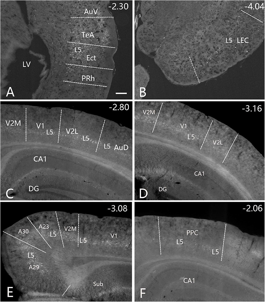 Six-panel grayscale brain section images, labeled A to F. Each panel displays different brain regions with annotations: Panel A shows AuV, TeA, Ect, and PRh near LV, labeled as -2.30. Panel B highlights L5 and LEC, labeled as -4.04. Panel C includes V2M, V1, V2L, AuD, CA1, and DG, labeled as -2.80. Panel D also shows V2M, V1, V2L, L5, CA1, and DG, labeled as -3.16. Panel E presents A30, A23, A29, Sub, alongside other regions, labeled as -3.08. Panel F highlights L5, PPC, and CA1, labeled as -2.06.
