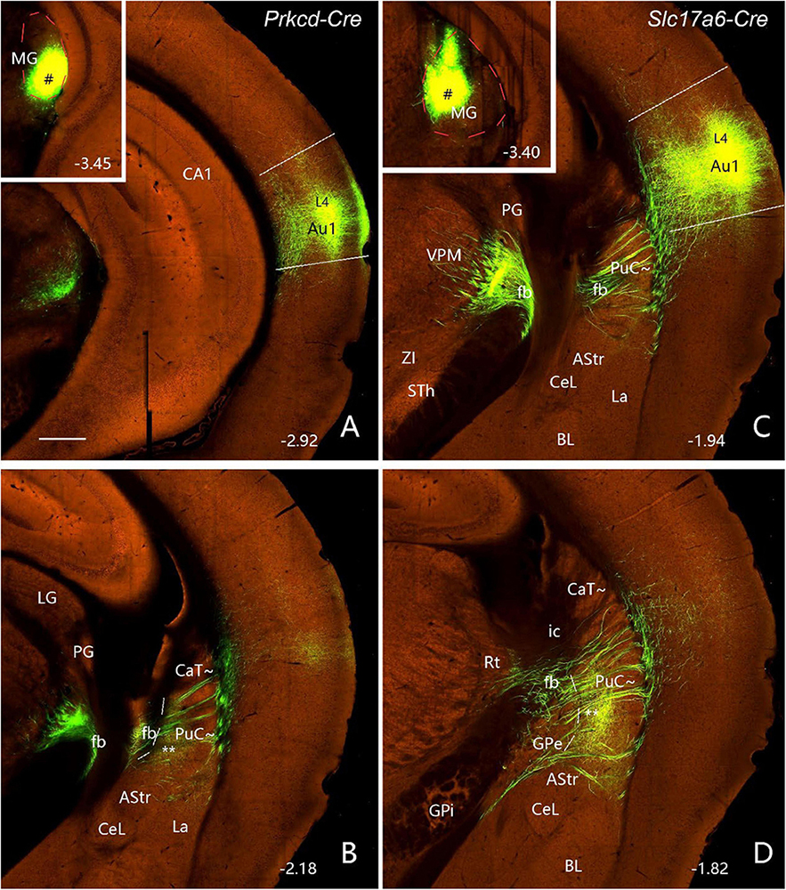 Four-panel brain microscopy image showing fluorescent labeling in orange and green. Each panel is labeled A-D with varying annotations: Prkcd-Cre and Slc17a6-Cre. Fluorescent regions highlight the medial geniculate, auditory cortex, and related areas, indicating neural pathways. Coordinates show section depth.