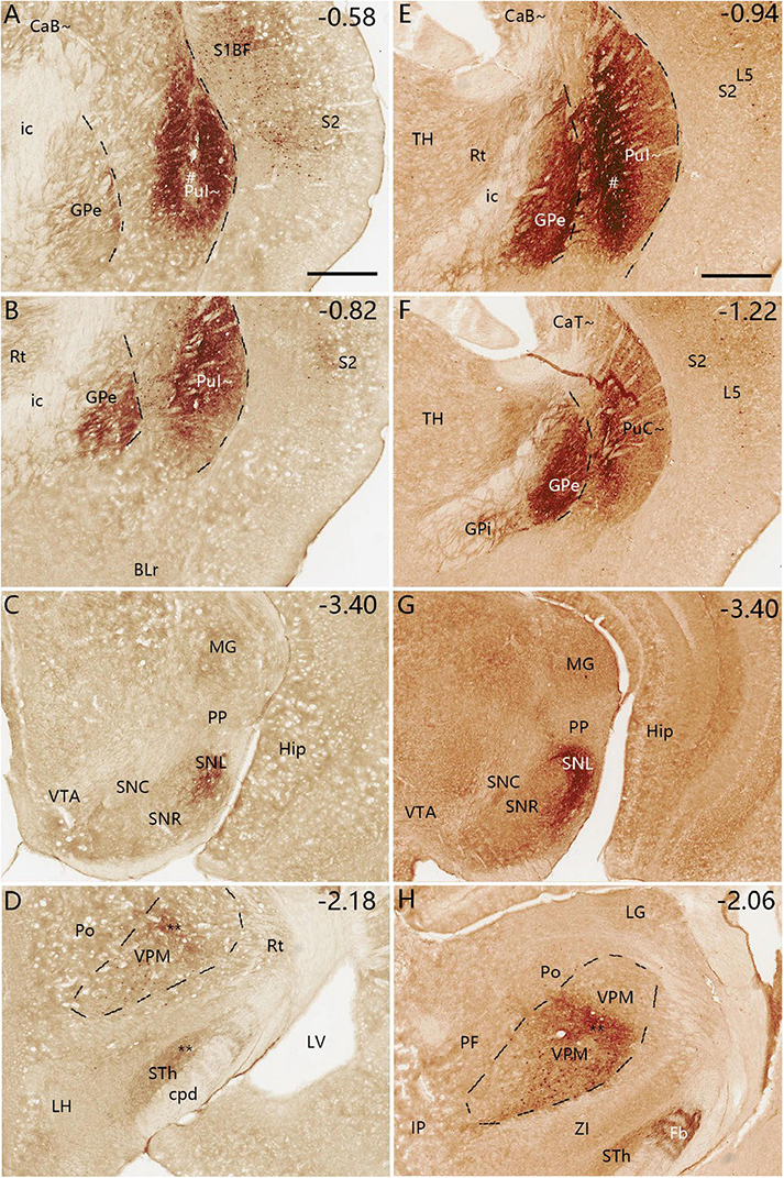 Brain tissue sections stained to highlight different regions. Images A to H display various structures labeled with abbreviations such as GPe, Pu1, and SNR, alongside numerical values indicating position. Each section varies in staining intensity and region demarcation.