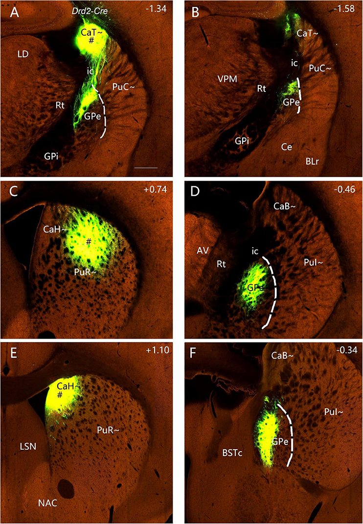 Slices of brain tissue in six panels labeled A to F show fluorescent markers highlighting specific brain regions. Notations include abbreviations such as CaT, GPe, and PuR, with numerical coordinates indicating slice positions. Bright green areas denote gene expression, and surrounding tissue appears in various shades of brown. Each panel showcases different neural structures and connections.