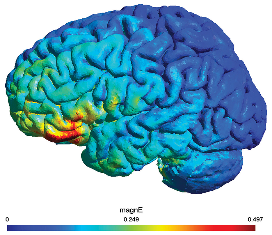 Color-coded brain map visualization showing different activity levels. Cooler blues indicate lower activity areas, while warmer reds and yellows signify higher activity. A color bar below indicates the scale from zero to zero point four nine seven.