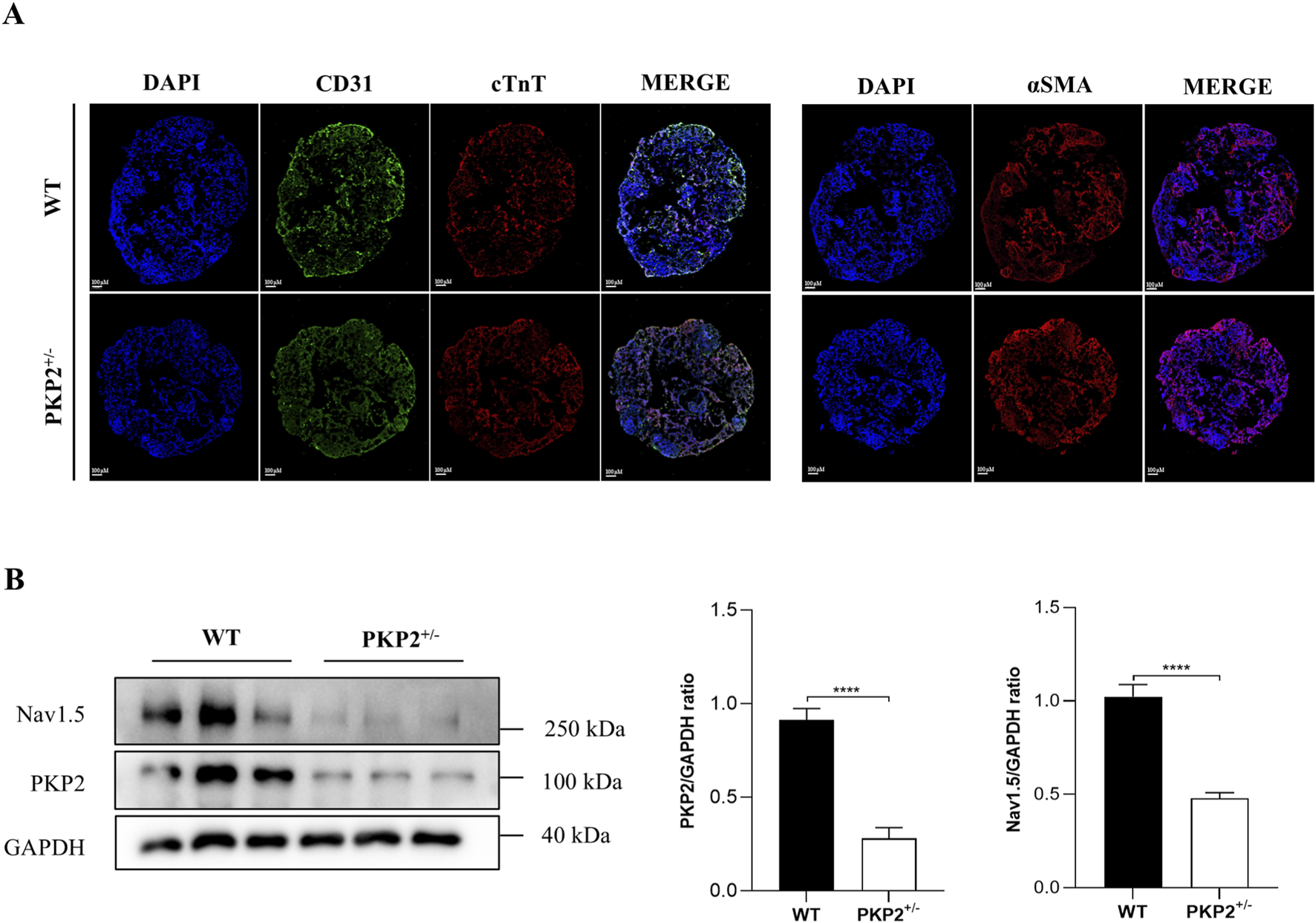 Panel A shows the immunofluorescence staining results of WT and PKP2+/− iPSC-derived cardiac organoids. Stains for DAPI, CD31, cTnT, and α-SMA are depicted, with merged images. Panel B displays Western blots for Nav1.5, PKP2, and GAPDH in WT and PKP2+/− cardiac organoids, alongside bar graphs indicatingPKP2/GAPDH and Nav1.5/GAPDH ratios, with significant differences marked by asterisks
