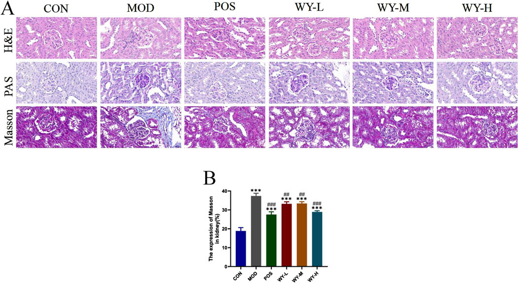 Histological comparison of kidney tissue sections in different groups shown in three staining methods: H&E, PAS, and Masson. Each column represents a group: CON, MOD, POS, WY-L, WY-M, WY-H. Image B is a bar chart illustrating Masson expression levels in kidney tissue across the groups, with higher expression in MOD and WY groups compared to CON. Asterisks and hash marks indicate statistical significance.