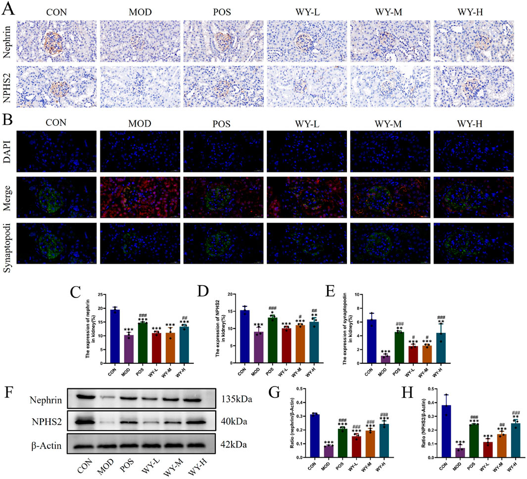 Image showing a series of immunohistochemical and fluorescence microscopy analyses labeled as A and B. Panel A displays images of nephrin and NPHS2 expressions under different conditions (CON, MOD, POS, WY-L, WY-M, WY-H). Panel B shows DAPI staining, merged images, and synaptopodin staining under similar conditions. Graphs C, D, and E depict quantitative data for nephrin, NPHS2, and synaptopodin expressions. Panel F shows Western blot results for nephrin, NPHS2, and β-Actin. Graphs G and H provide quantitative analysis of Western blot results.