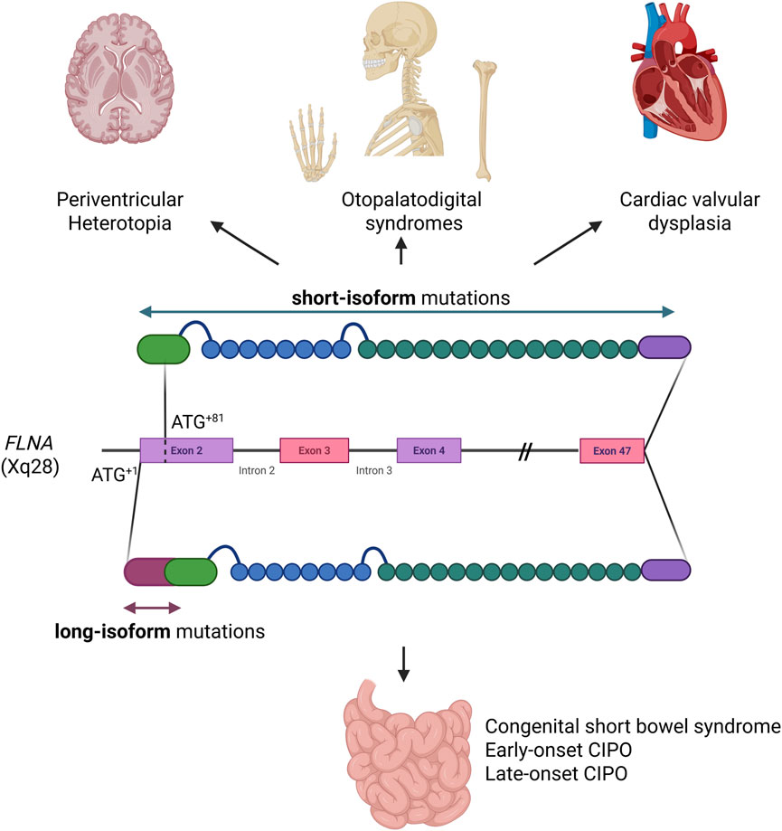 Diagram showing the genetic basis of disorders related to mutations in FLNA (Xq28) and their effects. Short-isoform mutations lead to periventricular heterotopia, otopalatodigital syndromes, and cardiac valvular dysplasia. Long-isoform mutations result in congenital short bowel syndrome, early-onset CIPO, and late-onset CIPO. The diagram includes representations of the brain, skeleton, heart, and intestines, along with a detailed view of the FLNA gene structure highlighting exons and introns.