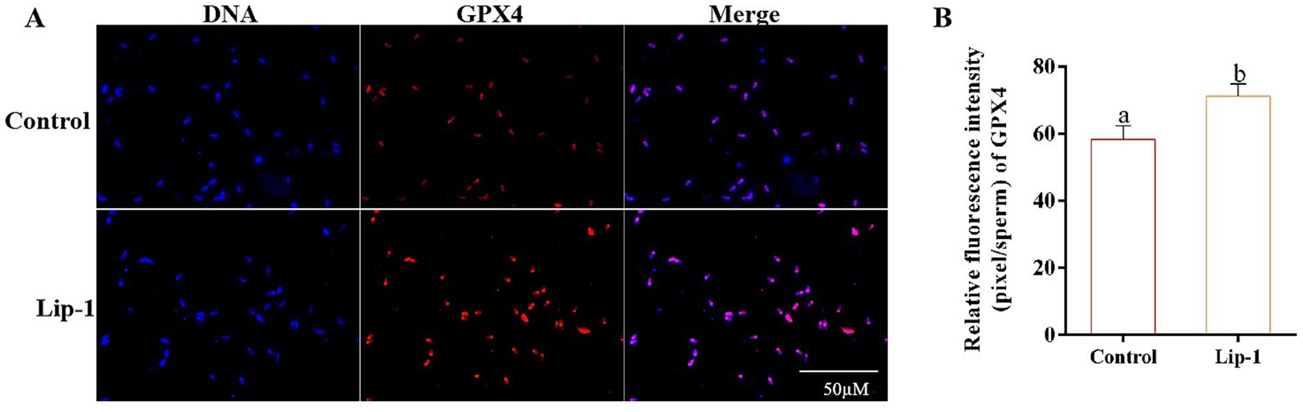Fluorescence microscopy and bar chart comparing GPX4 expression in sperm. Panel A shows DNA in blue and GPX4 in red, with merged images in purple, for control and Lip-1 treated samples. Panel B displays a bar chart of relative fluorescence intensity of GPX4, with Lip-1 showing higher intensity than control.