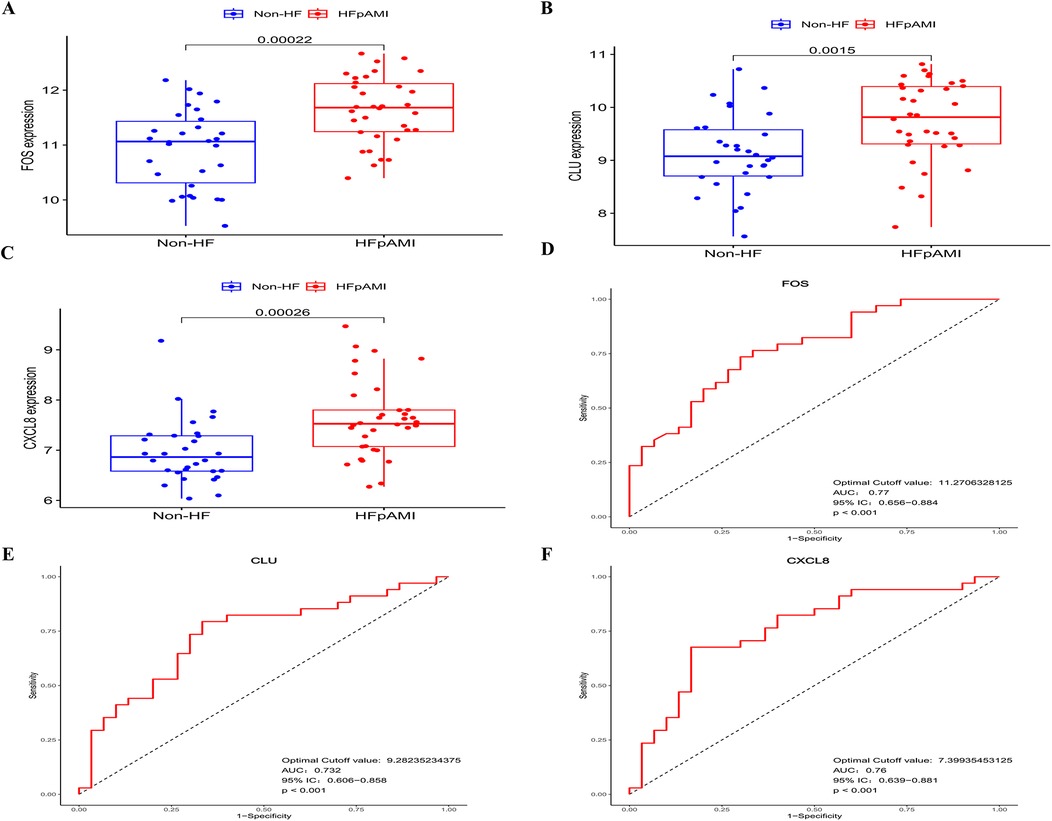 Graphs displaying the expression levels and diagnostic efficiency of biomarkers between Non-HF and HFpAMI groups. Panels A to C show box plots for FOS, CLU, and CXCL8 expression, respectively, with HFpAMI significantly higher than Non-HF for all biomarkers. P-values are displayed. Panels D to F are ROC curves indicating diagnostic accuracy for FOS, CLU, and CXCL8, with AUC values ranging from 0.76 to 0.77, p < 0.001, suggesting good diagnostic performance.