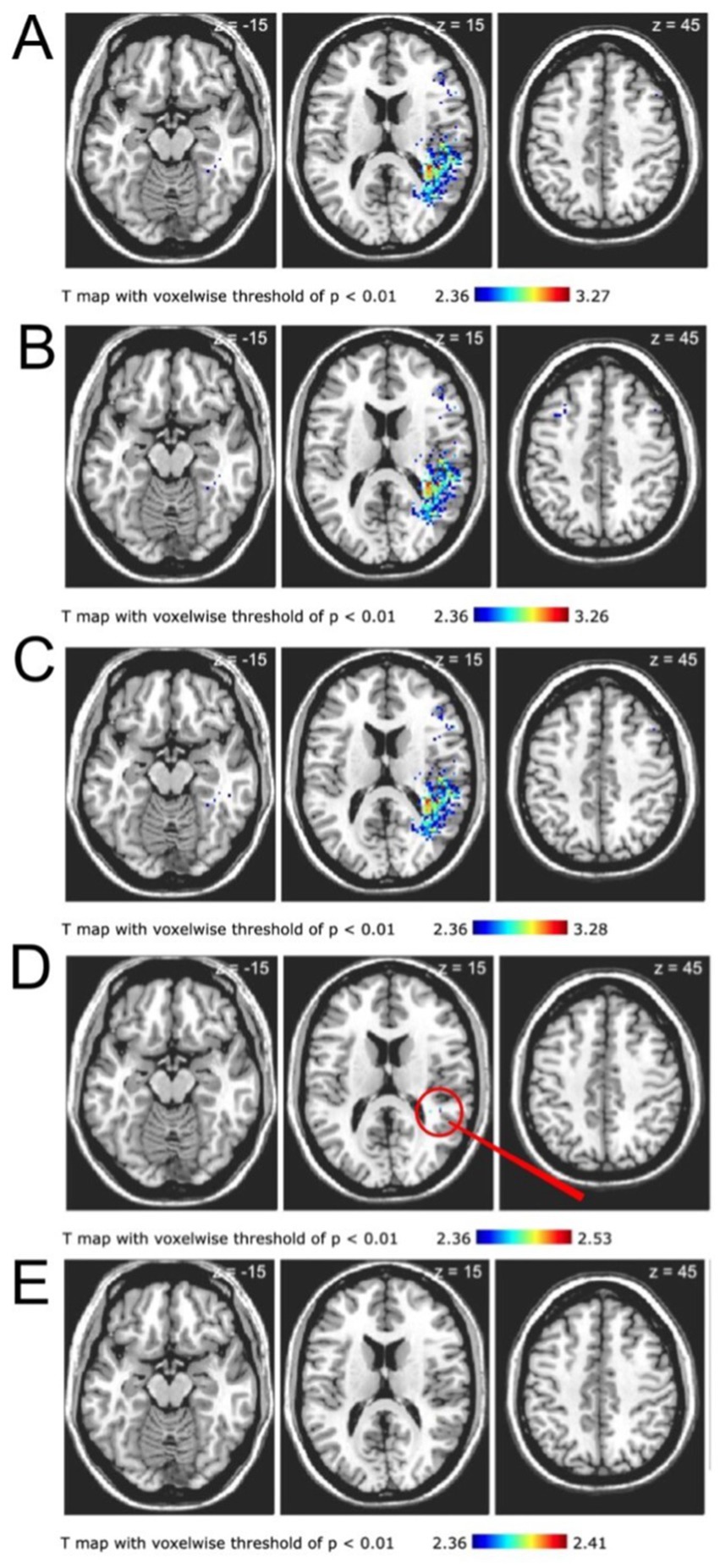 MRI brain scans labeled A to E, showing T maps with voxelwise threshold of p < 0.01. Images display axial slices at different z-coordinates (-15, 15, 45). Heatmaps indicate activation levels, with a color scale from 2.36 to 3.28 in A, B, and C, highlighting regions of significant change. Image D includes a red circle and line emphasizing a specific area of interest with a scale up to 2.53. Image E shows no highlighted areas, with scale up to 2.41.