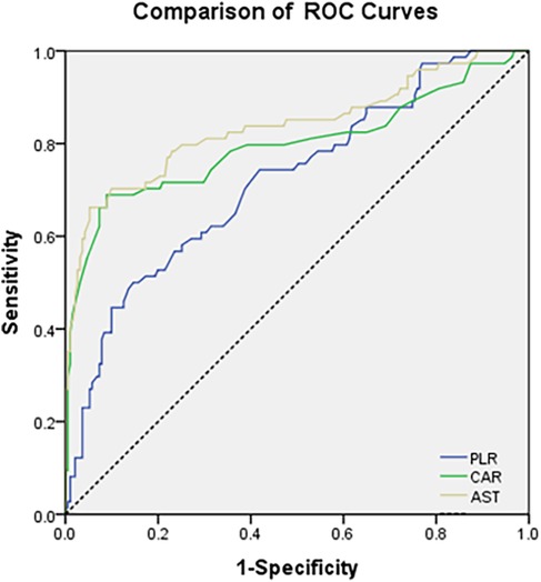 ROC curve comparison chart showing the diagnostic performance of three markers: PLR (blue line), CAR (green line), and AST (beige line). Sensitivity is plotted against 1-specificity, with the diagonal dashed line representing the reference line for no discrimination. Among the three, AST demonstrates the highest overall curve and best diagnostic accuracy, followed by CAR, while PLR shows comparatively lower sensitivity across most thresholds.