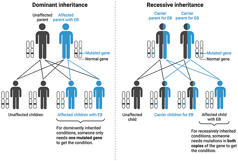 Diagram illustrating dominant and recessive inheritance of epidermolysis bullosa. On the left, it shows how dominant inheritance means that a child needs a mistake in only one copy of the gene (that is, from either the mother or father) to have the condition. On the right, it shows how a child needs mistakes in both copies of the gene (that is, from both parents) to have the condition. The icons for individuals with different genetic statuses are represented by different colors: black for unaffected, blue for affected, and half black and half blue for carriers.