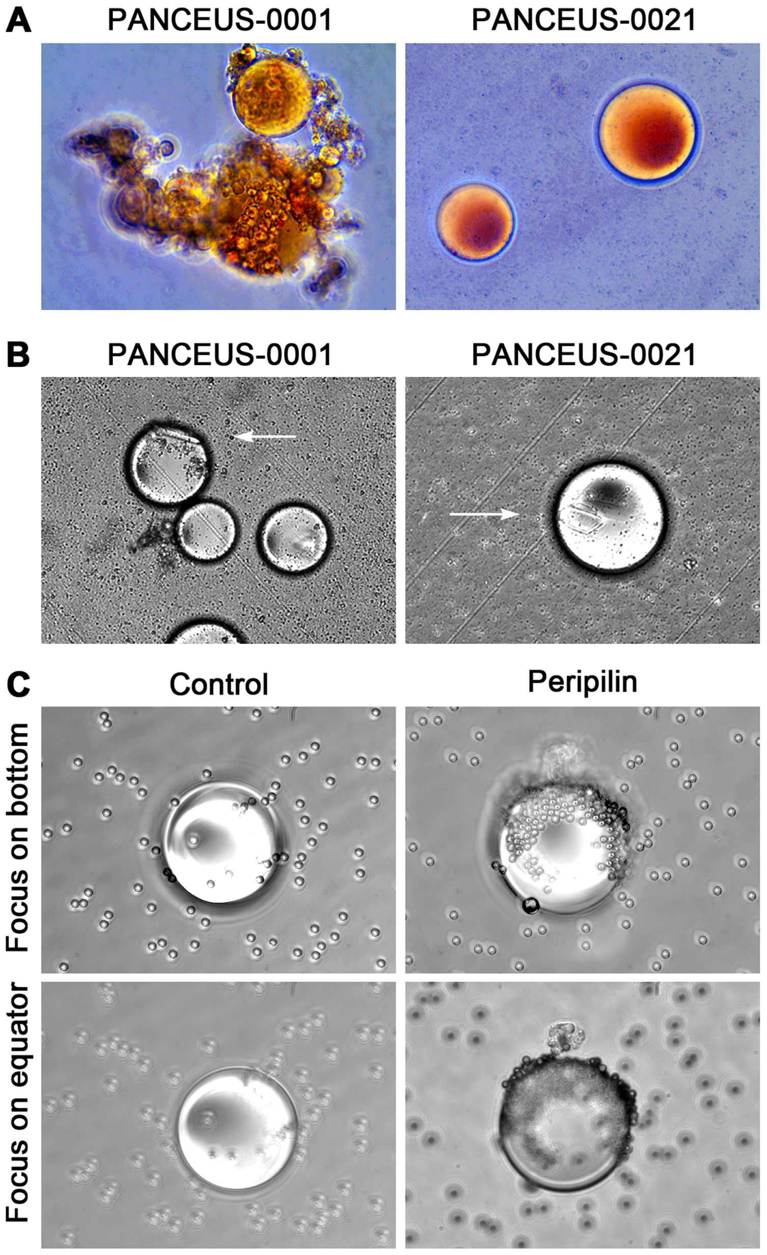 Panel of microscopic images showing lipid droplets in cells. Panel A displays lipid droplets from PANCEUS-0001 and PANCEUS-0021, visibly marked with orange staining. Panel B shows black and white images of the same droplets with arrows indicating specific features. Panel C compares control and peripilin-treated droplets, focused on the bottom and equator, displaying differences in droplet formation and aggregation.