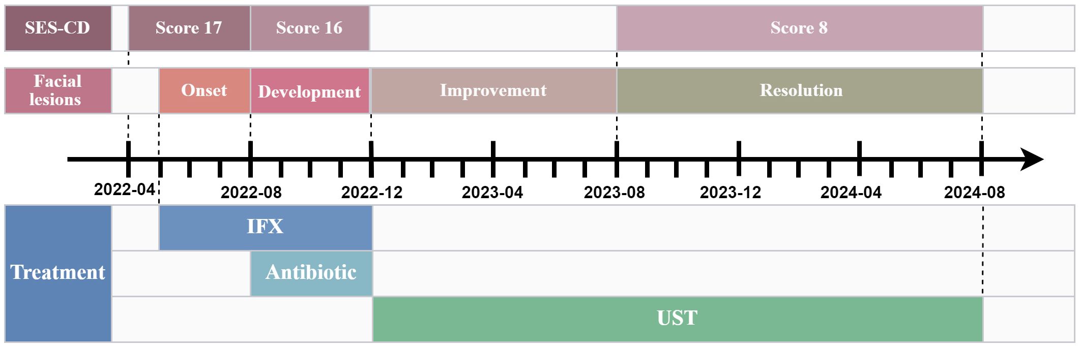 Timeline illustrating the progression of facial lesions and treatment. SES-CD scores decrease from seventeen to eight. Lesions onset in April 2022 with development by August 2022, improvement by August 2023, and resolution by April 2024. Treatments include IFX and antibiotics until August 2023, with UST starting thereafter.