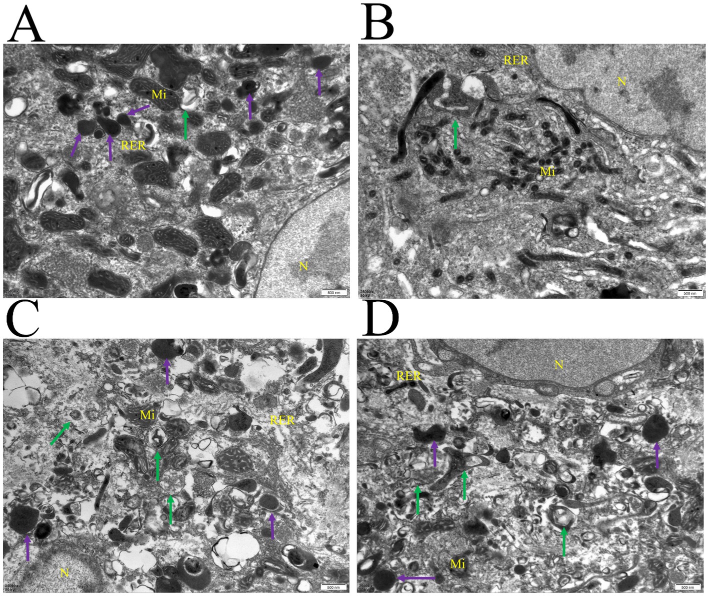 Electron microscopy images labeled A, B, C, D show detailed cellular structures. Labels indicate the nucleus (N), mitochondria (Mi), rough endoplasmic reticulum (RER), and unidentified elements marked with purple and green arrows. Magnification shows subcellular detail.