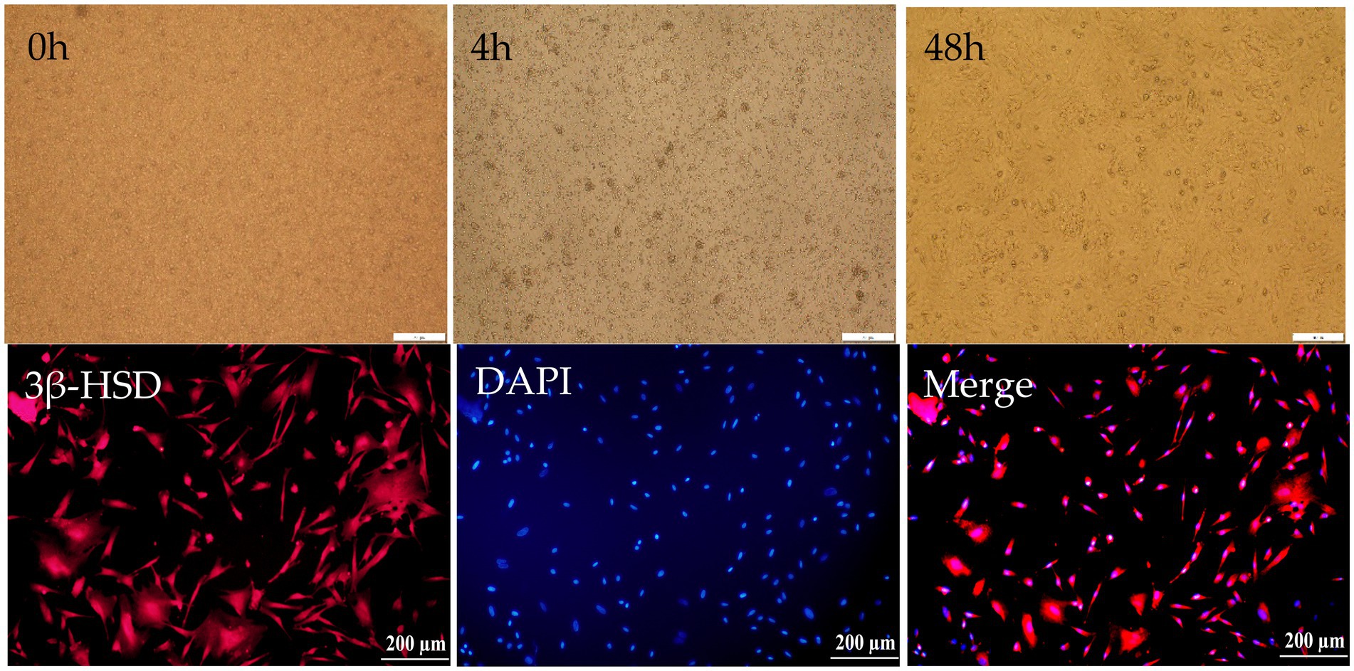 Microscopic images in two rows showing changes over time: 0 hours, 4 hours, and 48 hours. Top row: brown-stained cells at different times. Bottom row: fluorescent images. Left: 3β-HSD in red; middle: DAPI in blue; right: merged image showing overlap. Scale bar: 200 micrometers.
