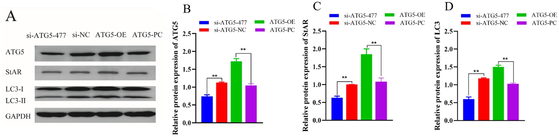 A composite image includes four panels: A) Western blot analysis showing protein levels of ATG5, StAR, LC3-I, LC3-II, and GAPDH across different treatments (si-ATG5-477, si-NC, ATG5-OE, ATG5-PC). B-D) Bar graphs depicting relative protein expression levels of ATG5, StAR, and LC3 respectively, for the same treatments. Bars are color-coded: blue for si-ATG5-477, red for si-ATG5-NC, green for ATG5-OE, and purple for ATG5-PC, with significant differences marked by asterisks.