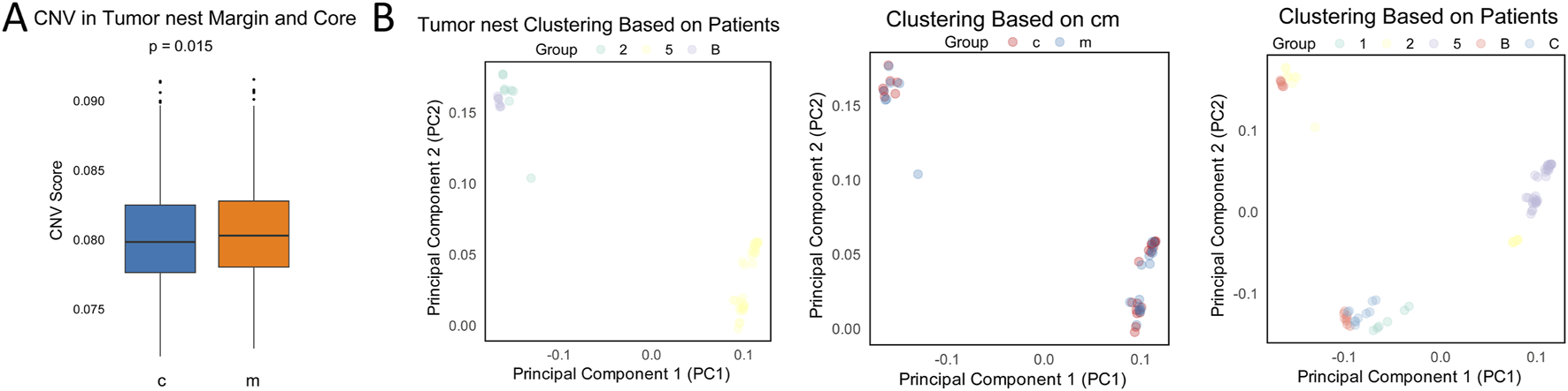 Box plot and three scatter plots analyzing CNV score and clustering in tumor nests. The box plot compares CNV scores between tumor nest margins and cores, with a p-value of 0.015. Scatter plots show clustering based on patients and conditions, using principal components for visualization. Different colors represent distinct groups.