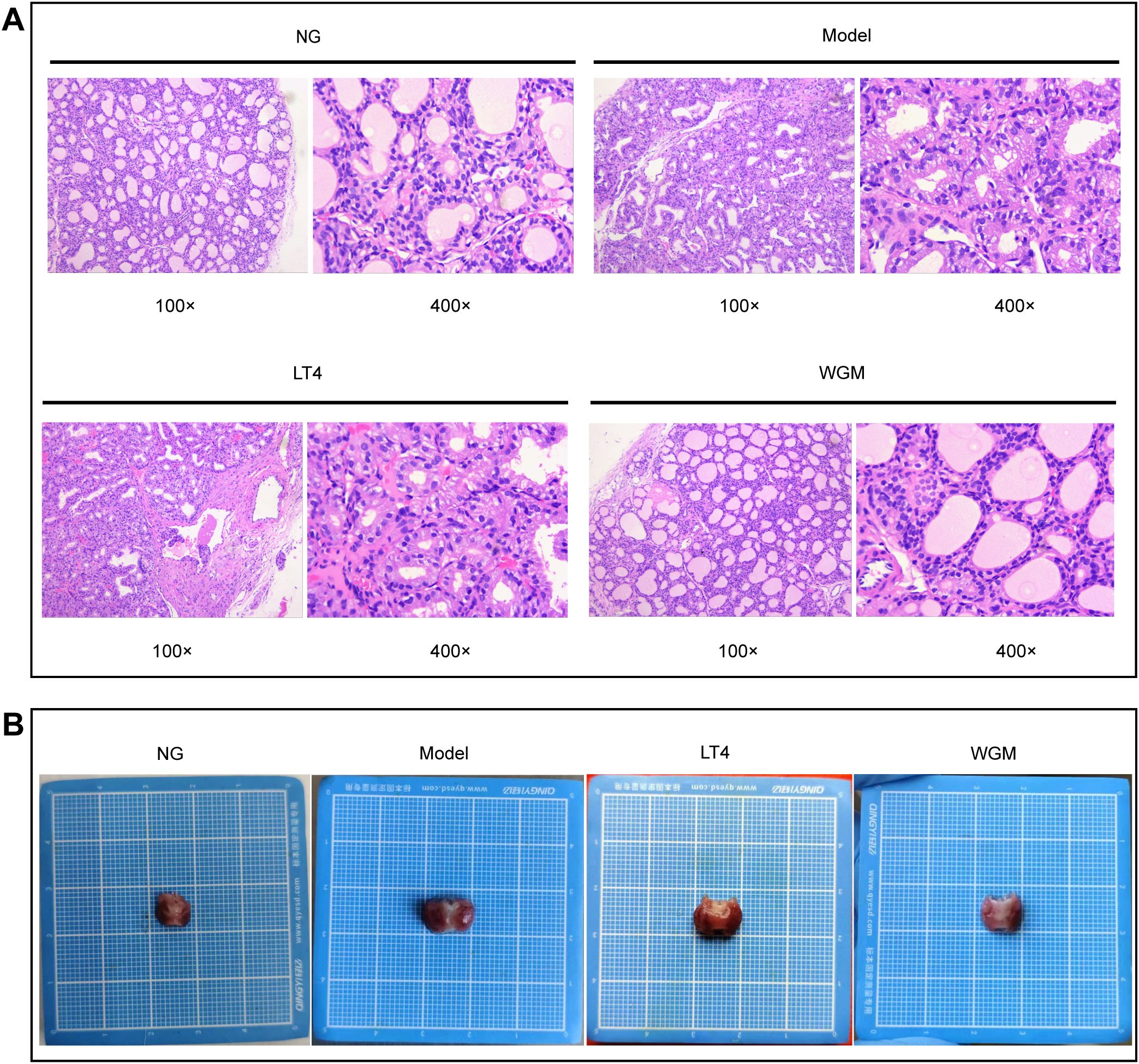 Panel A shows histological comparisons of thyroid tissue under different conditions at 100x and 400x magnifications: NG, Model, LT4, and WGM. Each displays varying cellular structures and densities. Panel B features gross images of thyroid tissues from NG, Model, LT4, and WGM groups placed on grid mats for scale comparison, showing size differences.