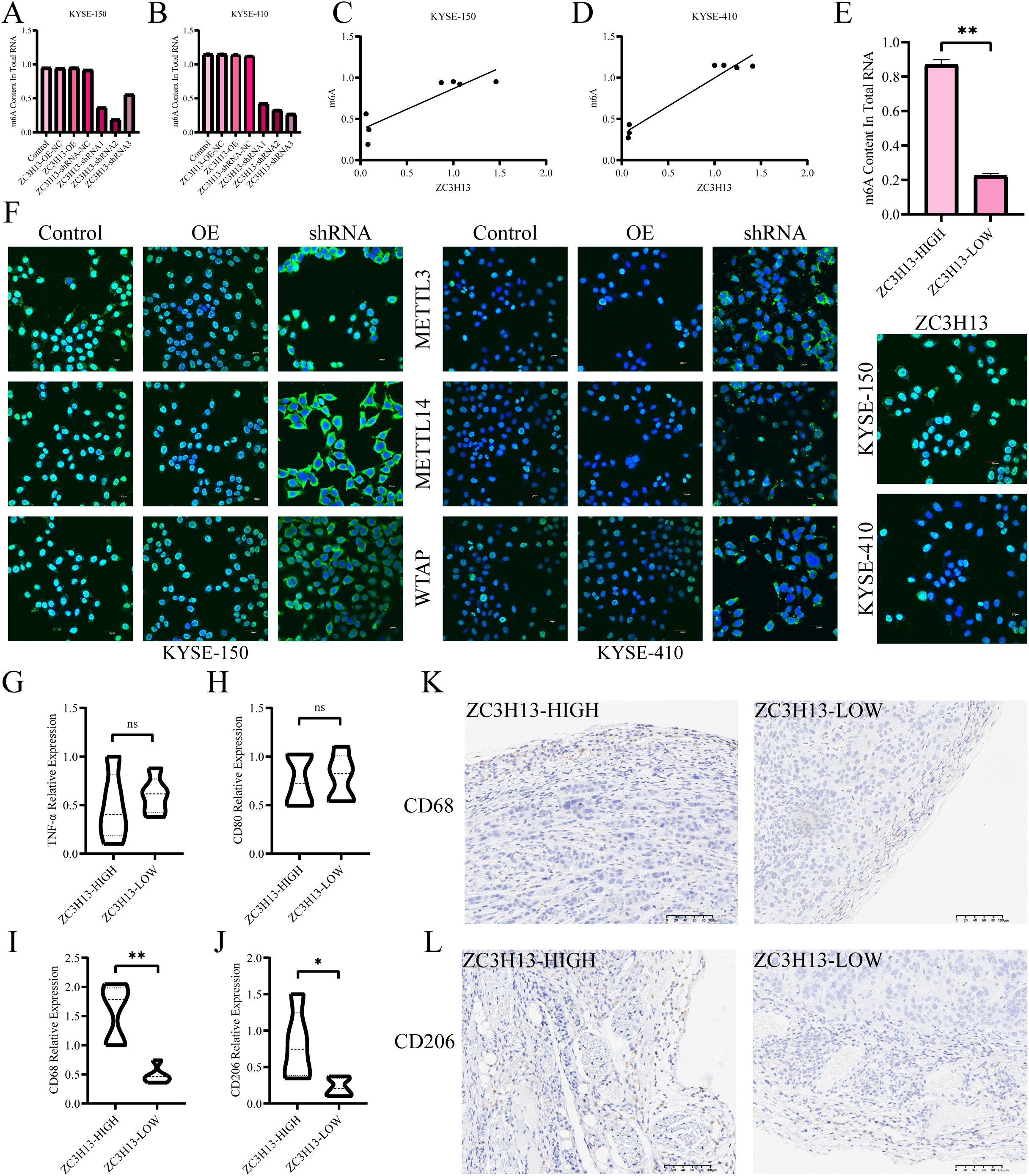 Chart panels illustrate gene expression and experimental results. Panels A and B show bar graphs of RNA levels in KYSE-150 and KYSE-410 cells. Panels C and D depict scatter plots correlating ZC3H13 with mRNA levels. Panel E presents a bar graph indicating m6A content differences. Panel F displays fluorescent images of cell lines for various proteins. Panels G to J are violin plots showing expression levels of specific genes. Panels K and L include tissue sections stained for CD68 and CD206, comparing ZC3H13 high and low expressions.