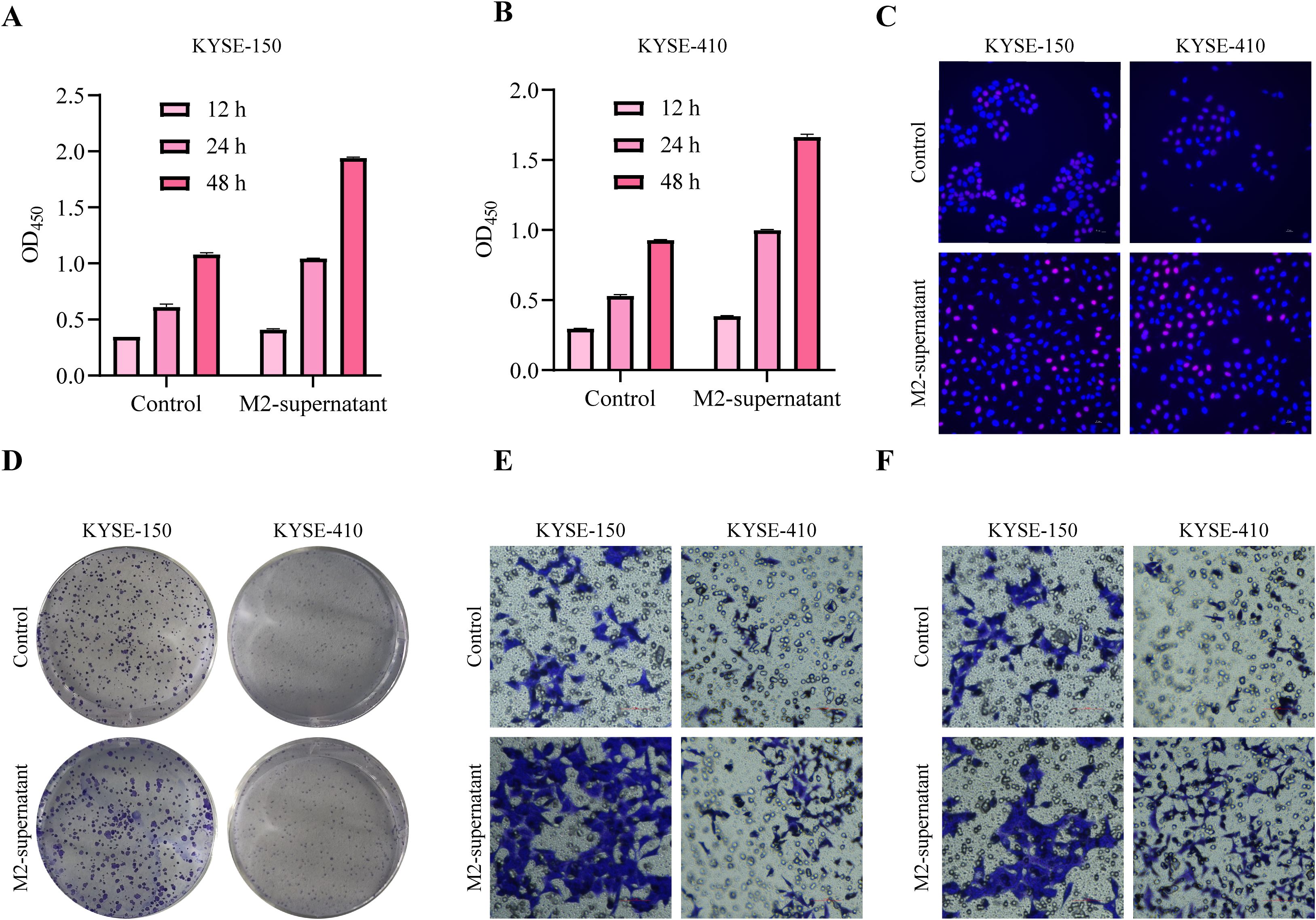 Graphs and images showing the effect of M2-supernatant on KYSE-150 and KYSE-410 cells. Panels A and B display bar charts of OD450 readings at 12, 24, and 48 hours. Panel C exhibits fluorescence microscopy images comparing control and M2-supernatant treatments. Panel D shows petri dishes with colony formations. Panels E and F depict stained cell cultures under different treatment conditions.