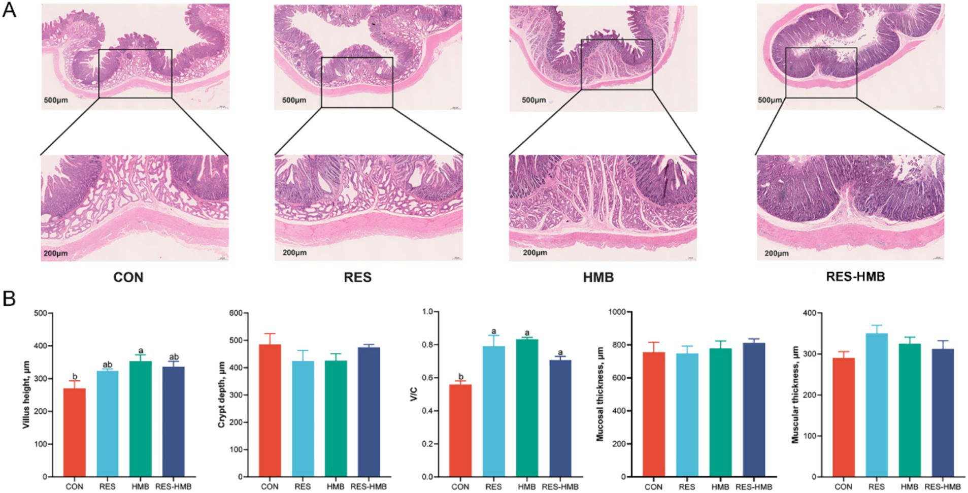 Histological section images of intestinal tissue under different treatments: CON, RES, HMB, and RES-HMB, magnified to show detail. Bar graphs below compare villus height, crypt depth, villus-to-crypt ratio, and mucosal thickness across these treatments, highlighting variation in tissue structure.