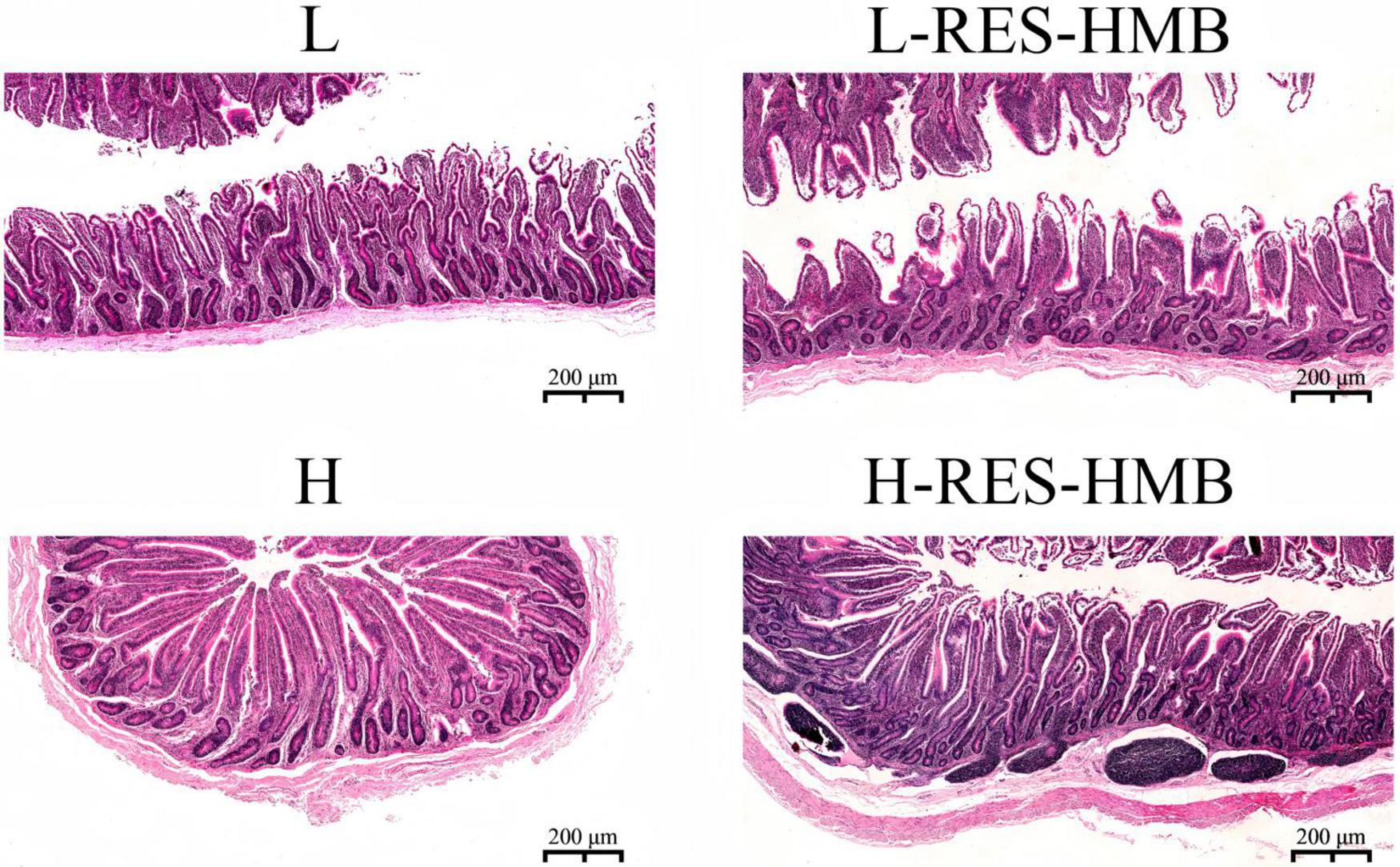 Microscope images show four histological sections labeled L, L-RES-HMB, H, and H-RES-HMB. Each section displays varying tissue structures. Labels indicate differences in treatment or condition. Scale bars are present, marked at 200 micrometers.