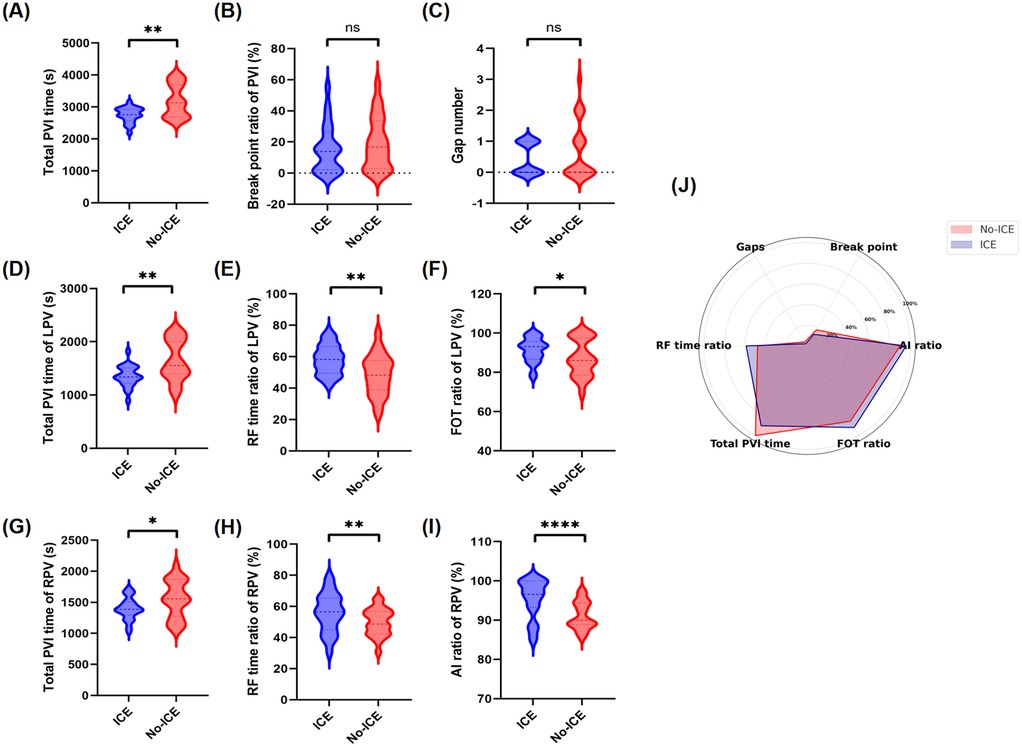 Violin plots compare ICE and No-ICE groups across nine metrics: (A) Total PVI time, (B) Break point ratio, (C) Gap number, (D) Total LPV time, (E) RF time ratio of LPV, (F) FOT ratio of LPV, (G) Total RPV time, (H) RF time ratio of RPV, (I) AI ratio of RPV. Significant differences are marked with asterisks. The radar chart in (J) compares the same parameters for both groups, highlighting differences between ICE and No-ICE.