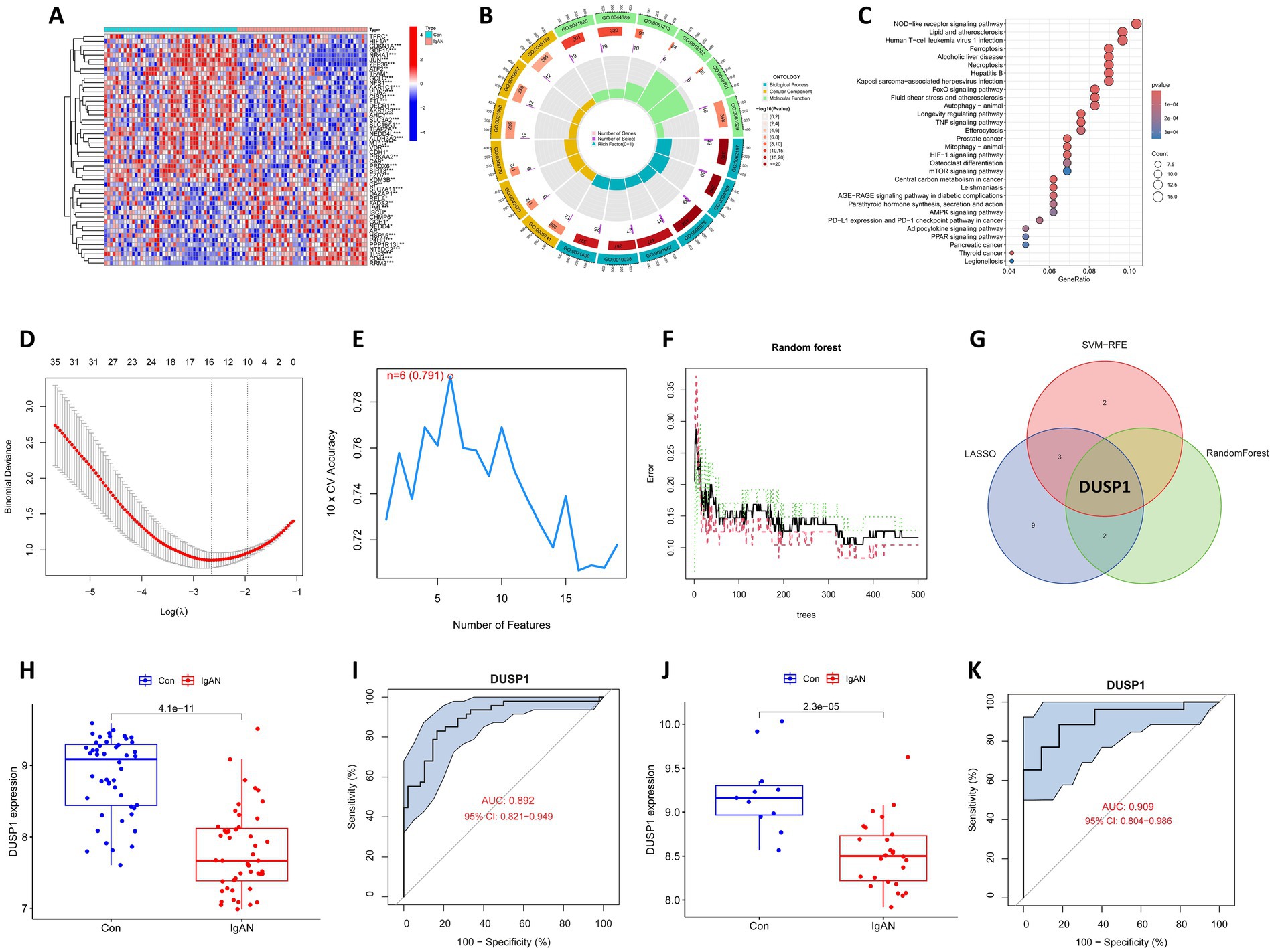 A collage of scientific data visualizations includes: A) A heatmap with hierarchical clustering. B) A circular diagram displaying gene ontology. C) A bubble plot for pathway enrichment analysis. D) A plot showing cross-validation error vs. log lambda. E) A line graph of cross-validation accuracy by feature number. F) An error rate plot for a random forest with trees. G) A Venn diagram showing overlap between SVM-RFE, LASSO, and Random Forest, highlighting DUSP1. H and J) Box plots comparing DUSP1 expression in controls vs. IgAN. I and K) Receiver operating characteristic (ROC) curves for DUSP1 with AUC values.