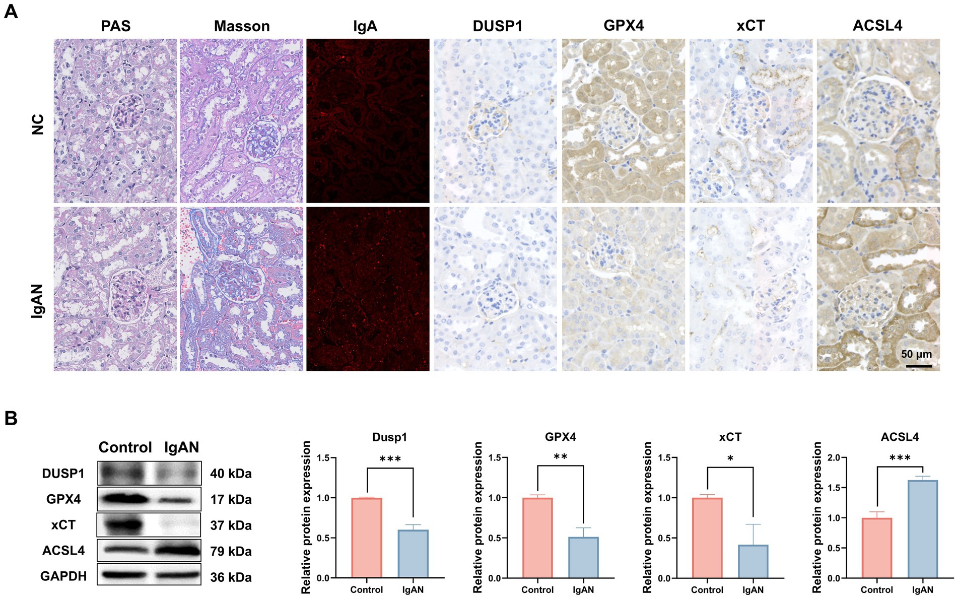 Panel A shows histological and immunohistochemical comparisons between NC and IgAN kidney tissues using PAS and Masson stains, IgA, DUSP1, GPX4, xCT, and ACSL4 markers. Panel B includes Western blot analysis showing protein expression levels of DUSP1, GPX4, xCT, ACSL4, and GAPDH, with bar graphs indicating significant differences in expression between control and IgAN groups.