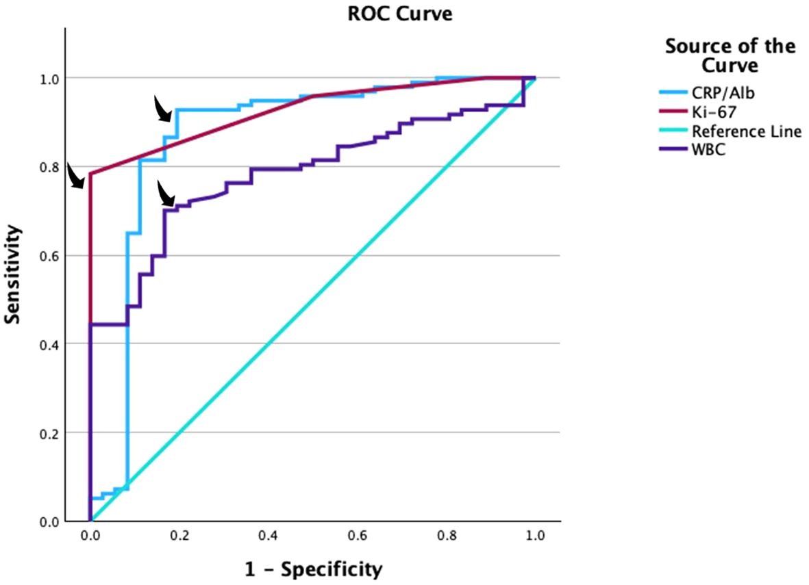 ROC Curve displaying four lines: CRP/Alb (light blue), Ki-67 (red), Reference Line (cyan), WBC (purple). Axes show Sensitivity versus 1-Specificity. The Ki-67 line is closest to the top left, indicating better performance.