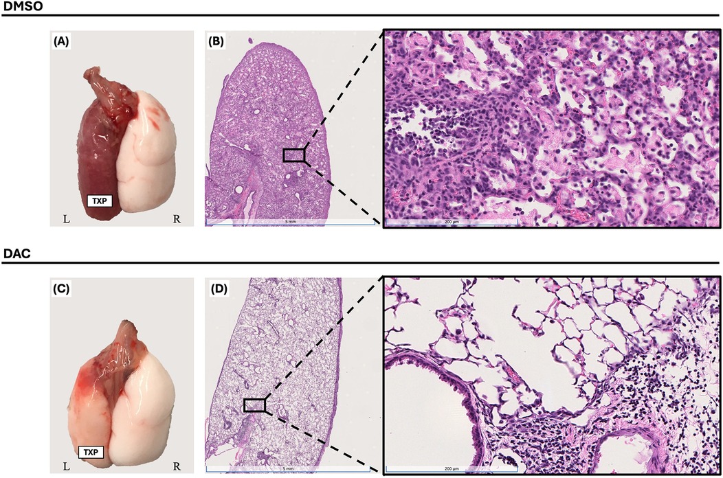 Two panels comparing lung tissue treated with DMSO and DAC. Top section (A, B) shows a DMSO-treated left lung with a darker color on the left lung and a histological section with dense, darkly stained cells. Bottom section (C, D) shows a DAC-treated lung with a lighter coloring, and the histological section displays less dense cell structures with more open spaces. Both histological sections feature purple and pink staining, highlighting cellular details.