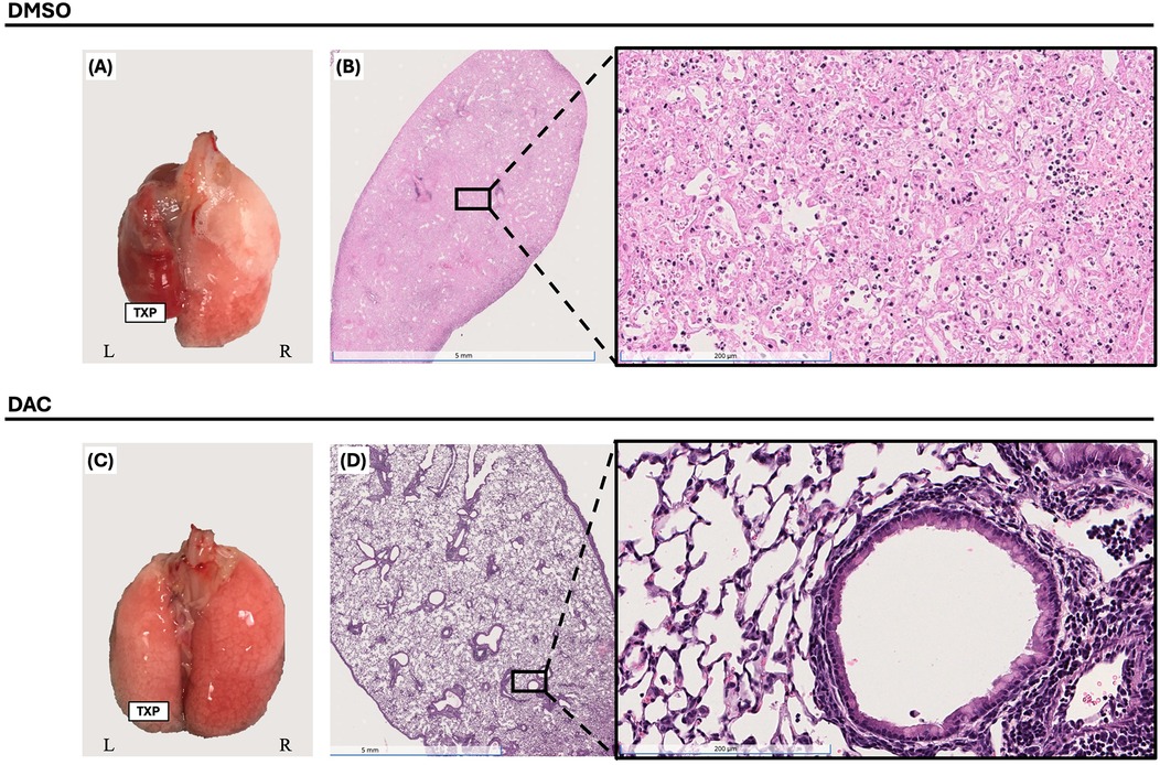 Comparison of lung tissues under different treatments. Panel A and B show lung morphology and histology after DMSO treatment, with dense tissue and cellular detail. Panel C and D depict lung morphology and histology after DAC treatment, revealing structured alveolar spaces and distinct tissue architecture. Both treatments show different microscopic appearances, highlighting the impact on lung tissue.