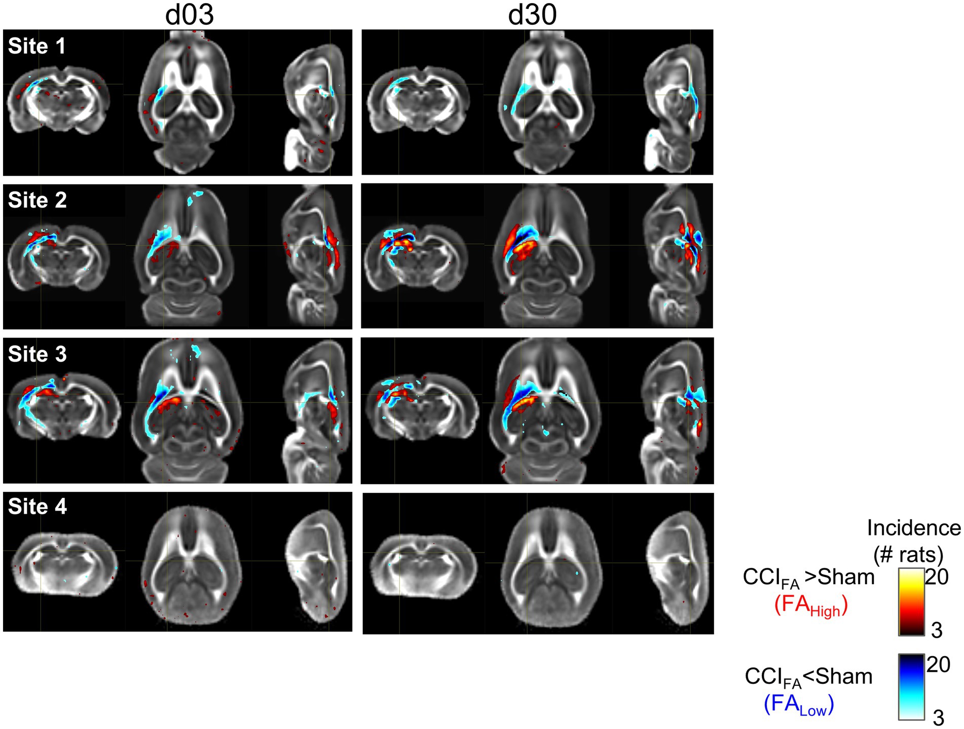 MRI images showing brain scans from four different sites on days three and thirty (d03 and d30). The scans highlight areas with changes in fractional anisotropy, indicated by color gradients. Red represents higher incidences, while blue represents lower incidences. A color legend on the right differentiates the incidence levels.