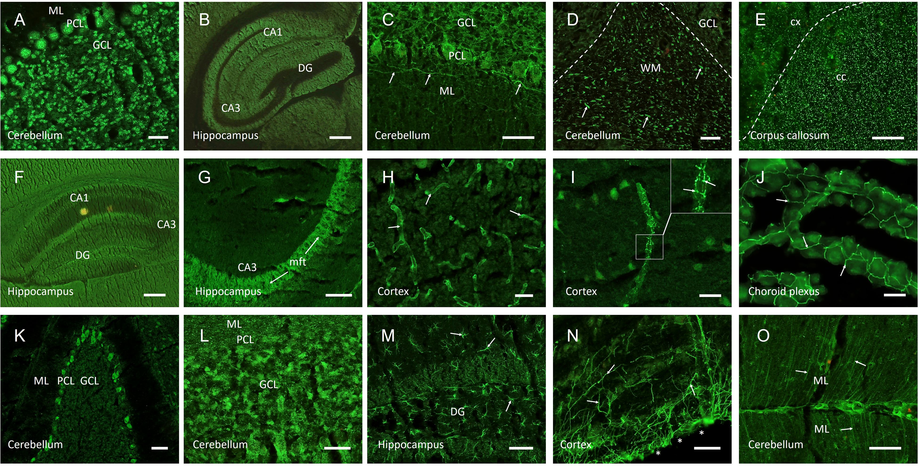 Microscopic images of brain regions stained in green fluorescence. Panels A, C, K, L, and O show cerebellum sections highlighting molecular (ML), Purkinje cell (PCL), and granular cell (GCL) layers. Panels B, F, and G display hippocampus sections marking CA1, CA3, and dentate gyrus (DG). Panels D, E, and I depict cortex and corpus callosum (CC) areas. Panel H shows cortex features with prominent vascular structures. Panel J highlights the choroid plexus with outlined cell boundaries. Panel M focuses on the dentate gyrus with distinct cellular features. Thin arrows indicate specific structures across the images.