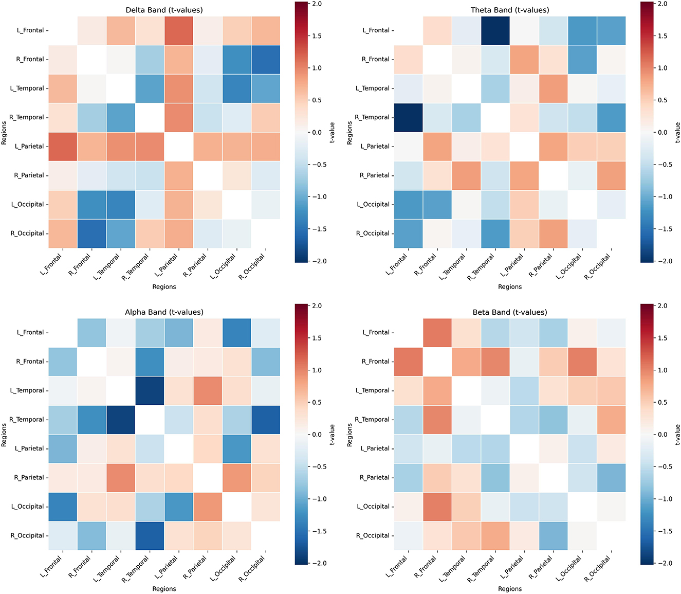 Heatmaps displaying t-values of brain regions for Delta, Theta, Alpha, and Beta bands. Each map shows variations in color intensity from blue to red, indicating different t-values across brain regions such as Frontal, Temporal, Parietal, and Occipital, divided into left and right sides. A color scale bar accompanies each map, ranging from negative two to positive two.